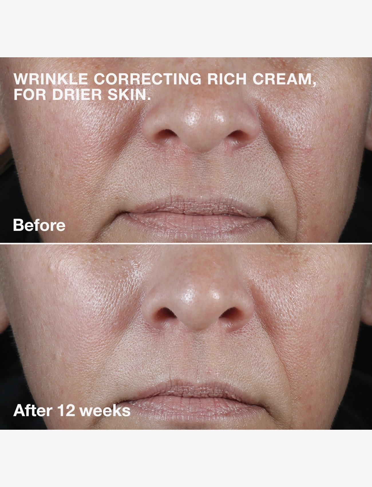 Clinique - Smart Clinical Repair Wrinkle Face Cream Rich - sommerens hudpleje - no colour - 1