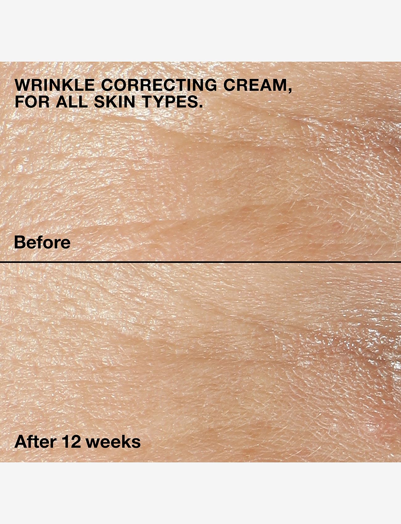 Clinique - Smart Clinical Repair Wrinkle Face Cream - sommerens hudpleje - no colour - 3