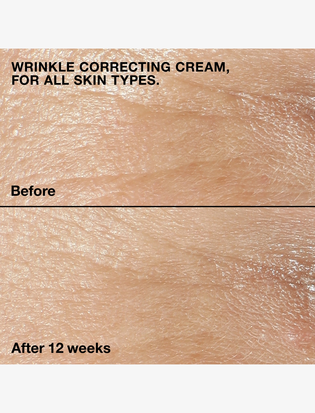 Clinique - Smart Clinical Repair Wrinkle Face Cream - sommarens hudvård  - no colour - 3