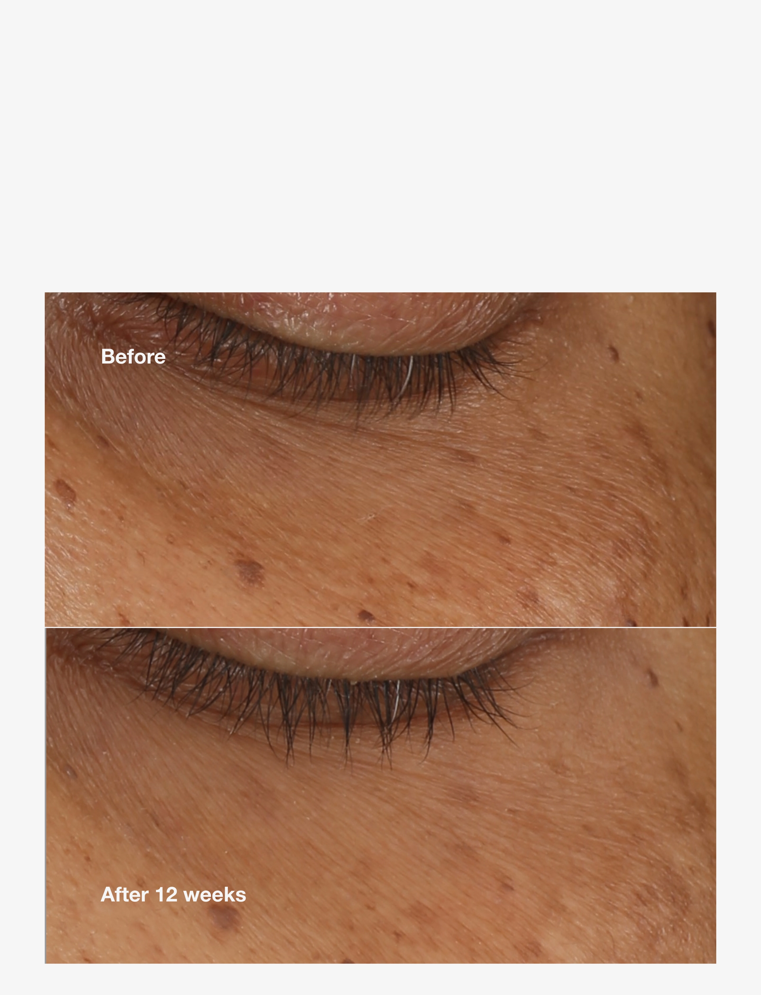 Clinique - All About Eyes Brightening Serum Concentrate - kesäiho - multi - 2