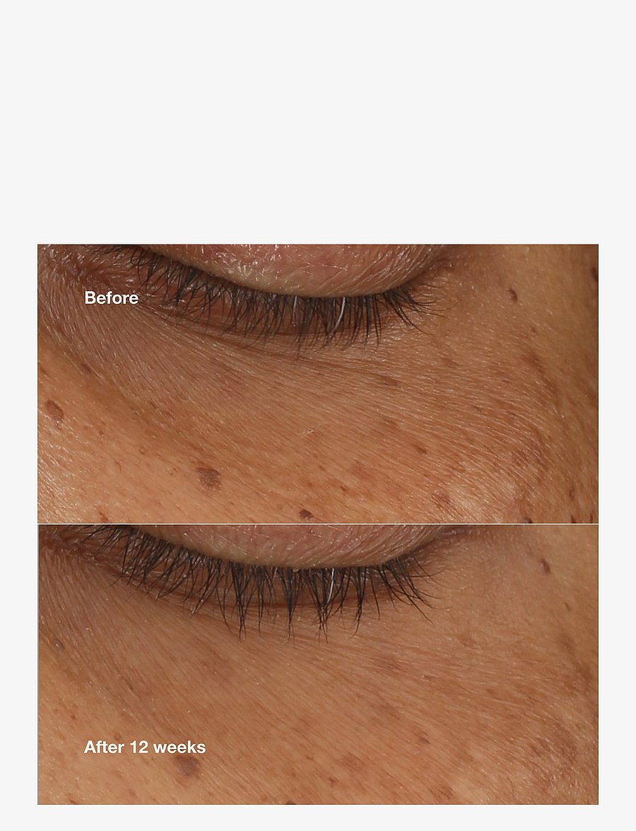 Clinique - All About Eyes Brightening Serum Concentrate - Ögonserum - multi - 2