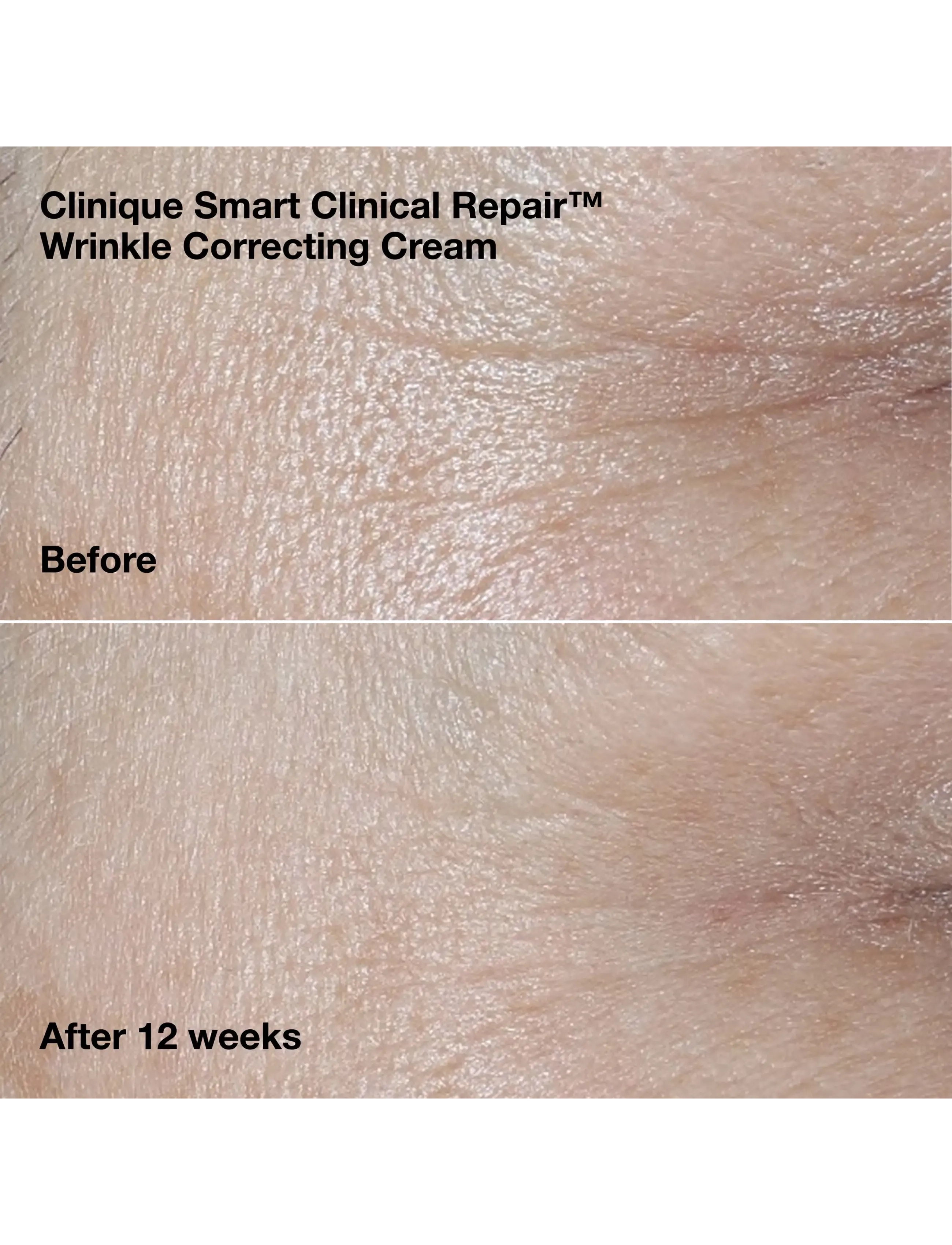 Clinique - Wrinkle-Correcting Routine Set - no color - 2