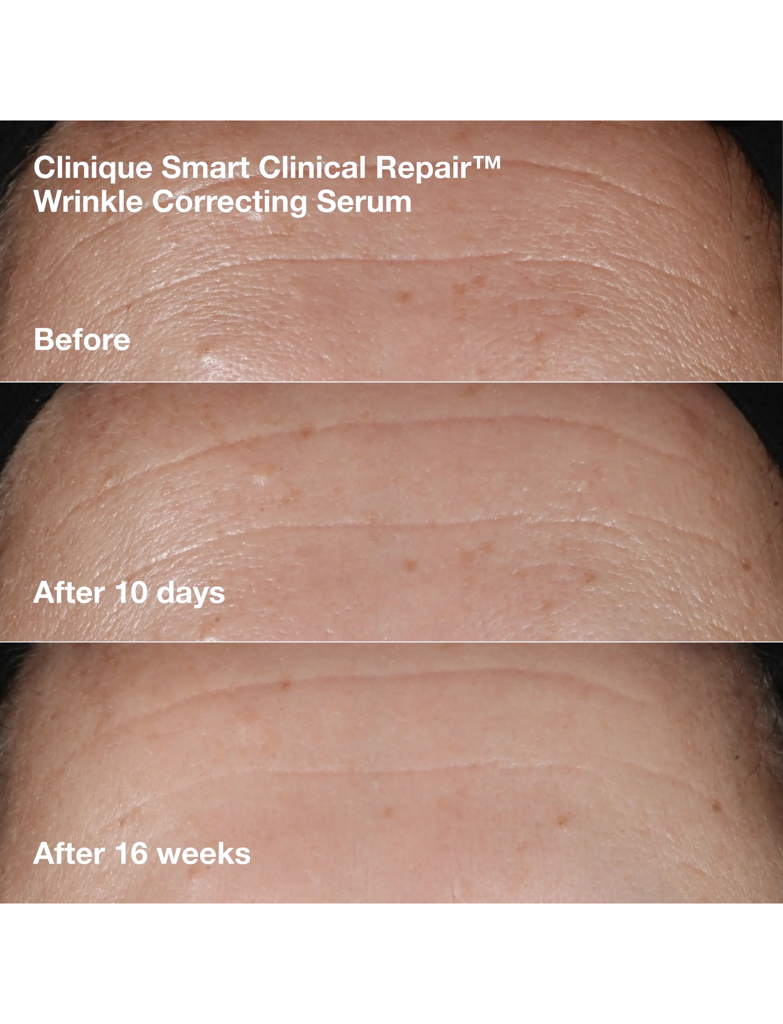 Clinique - Wrinkle-Correcting Routine Set - no color - 3