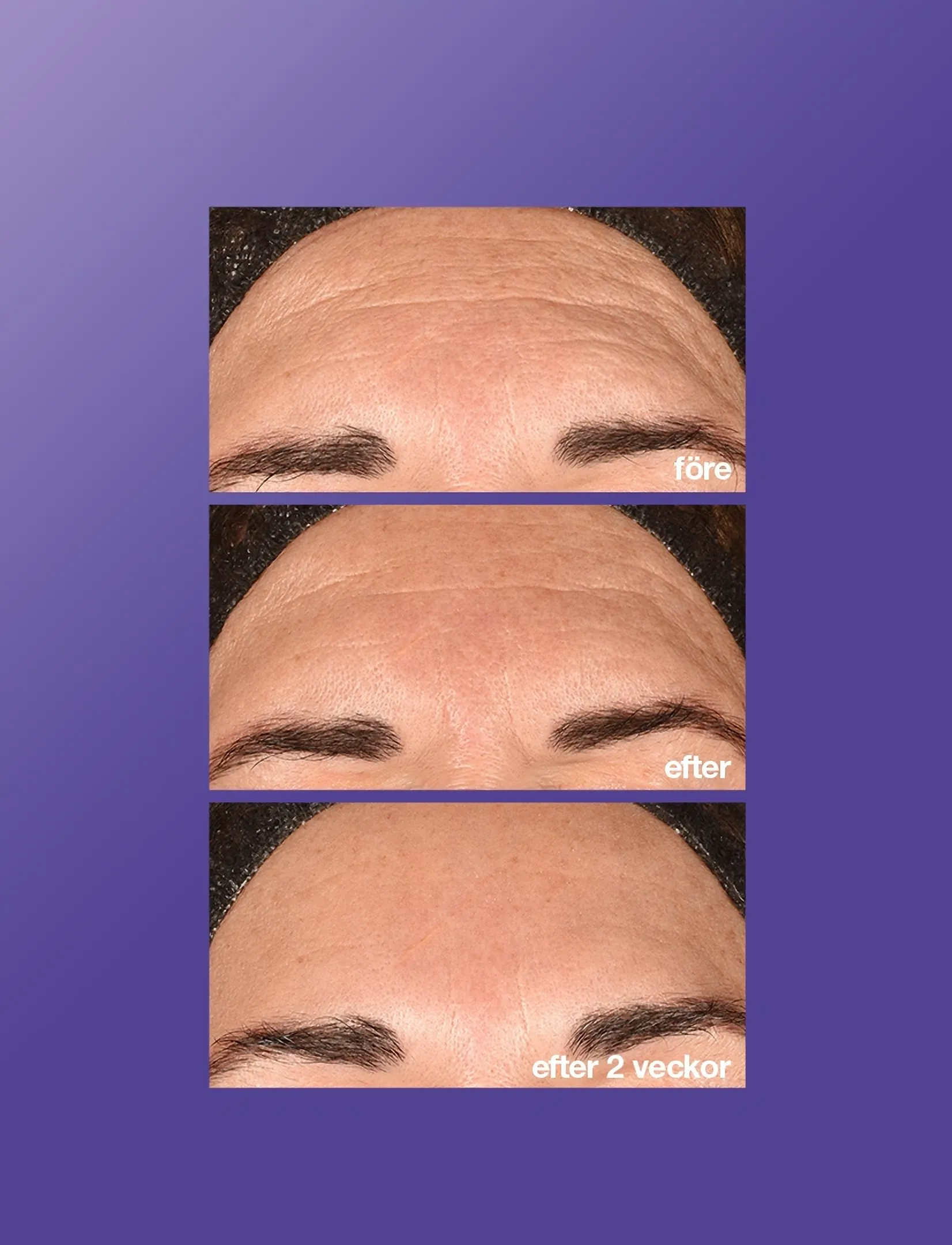 Dermalogica - Phyto Nature E² - peeling - ansikte  - na - 3