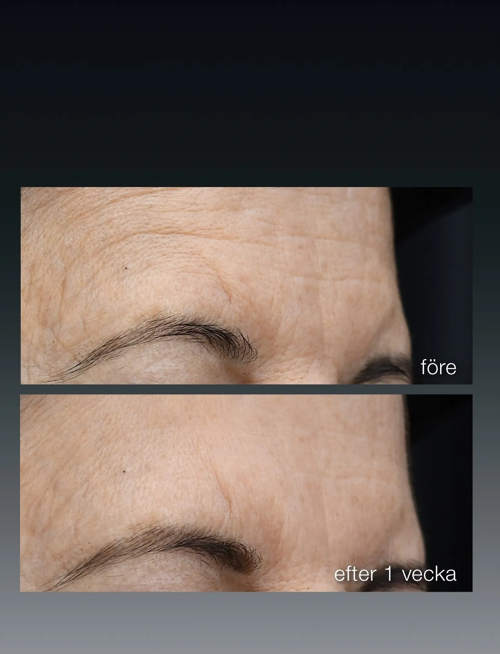 Dermalogica - FutureCode Booster - na - 3