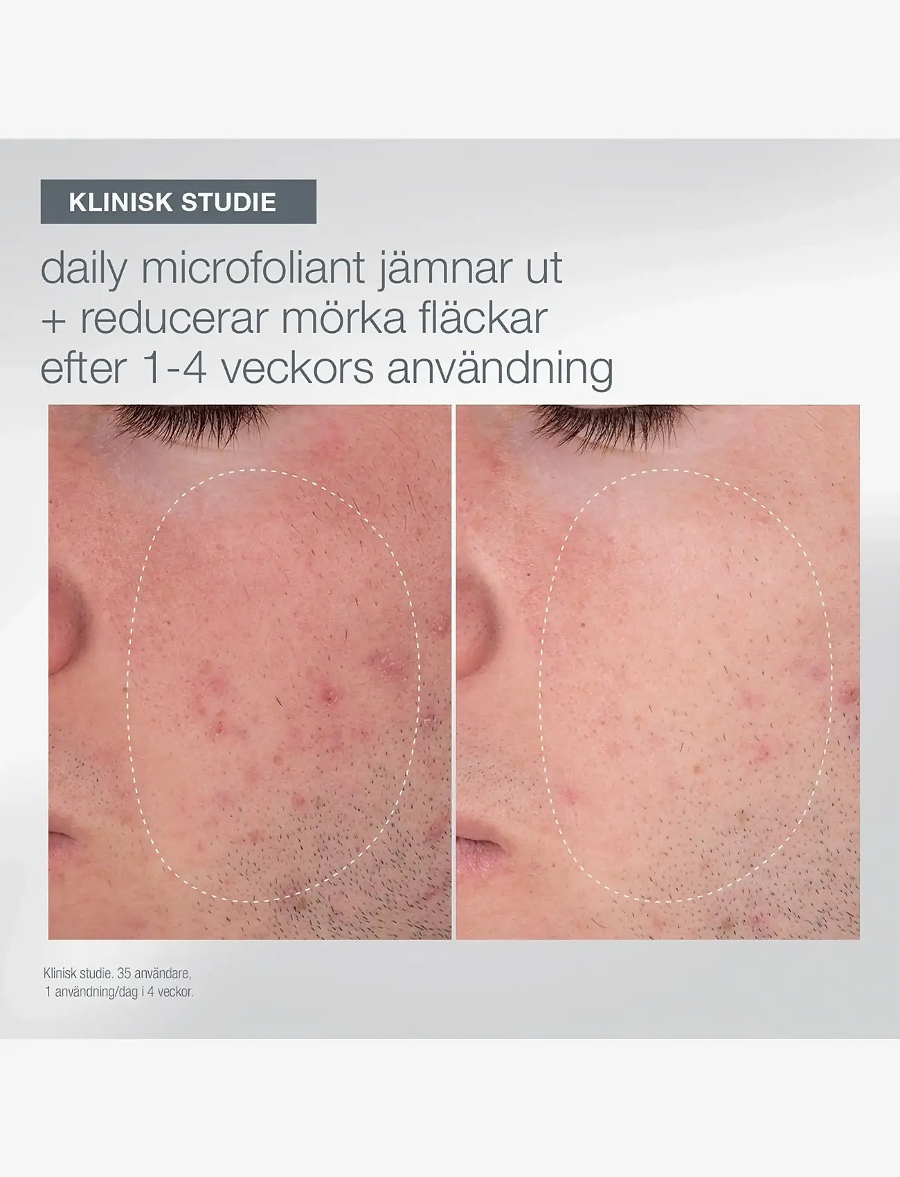 Dermalogica - Light Up the Room - gåvoset - na - 5
