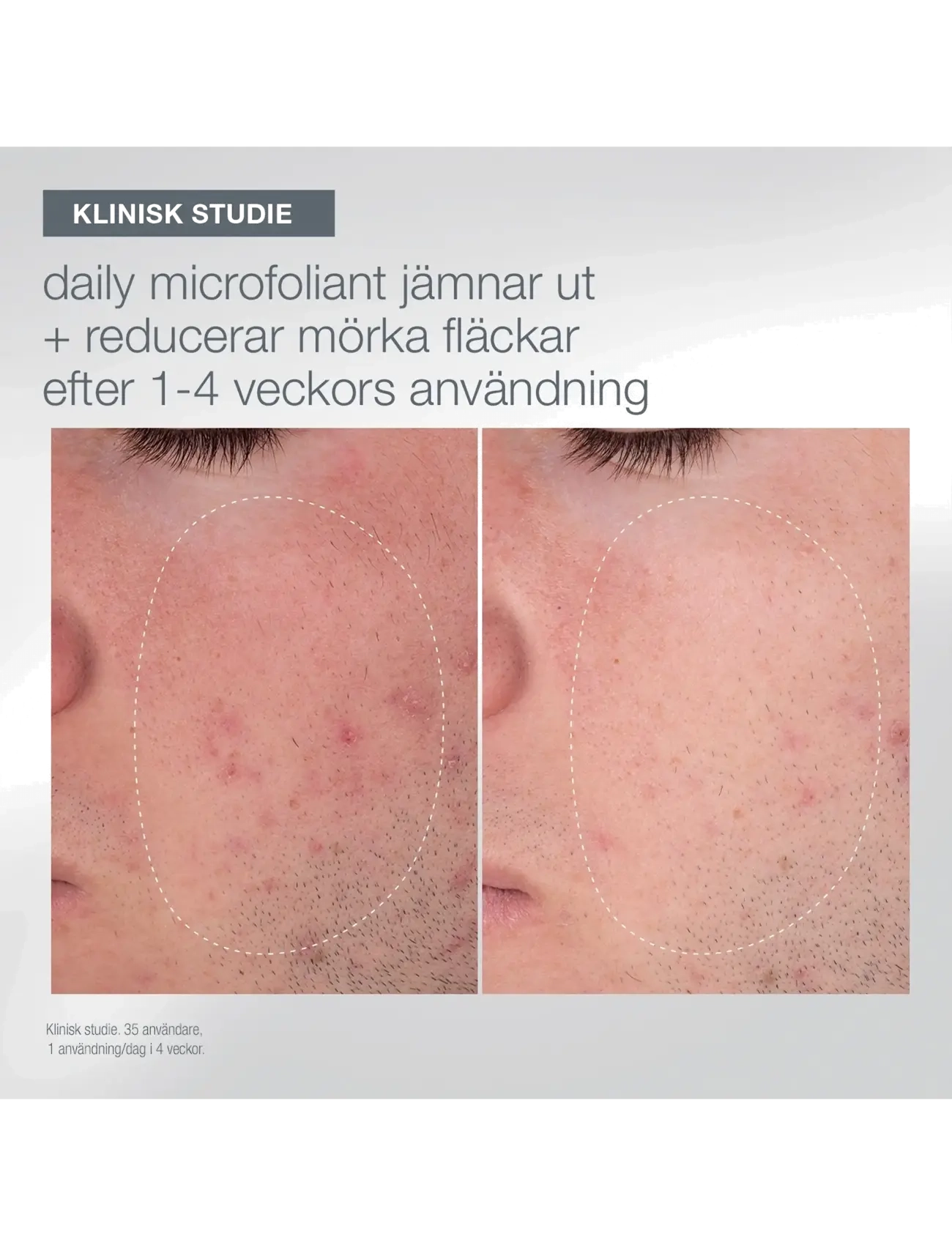 Dermalogica - Light Up the Room - gåvoset - na - 5