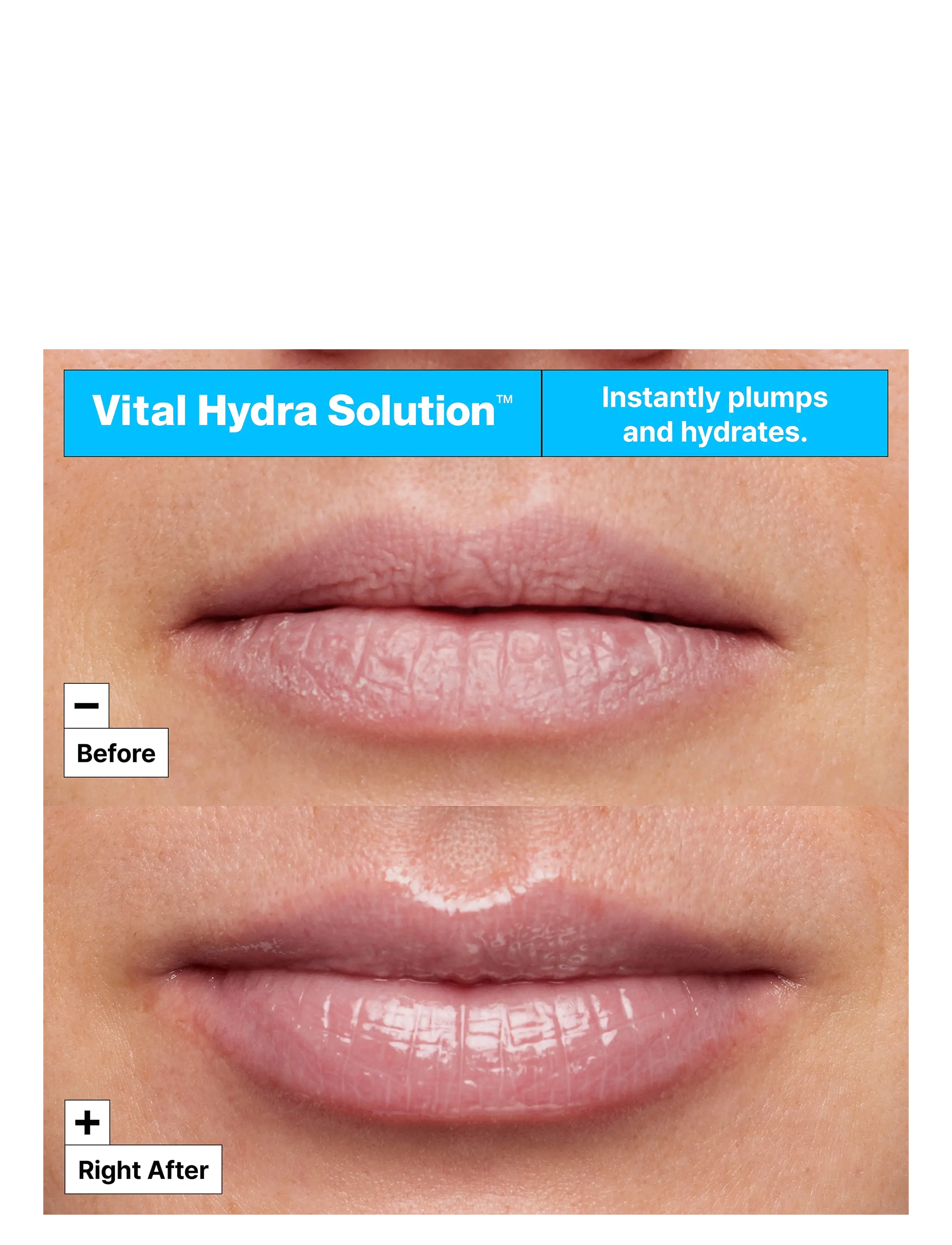Vital Hydra Solution Hydrating Lip Mask 4