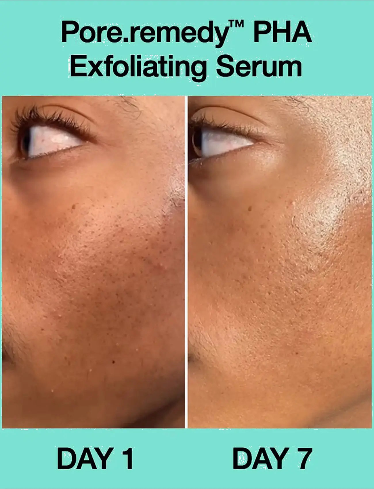 Dr.Jart+ - Pore·remedy PHA Exfoliating Serum - serum - clear - 2