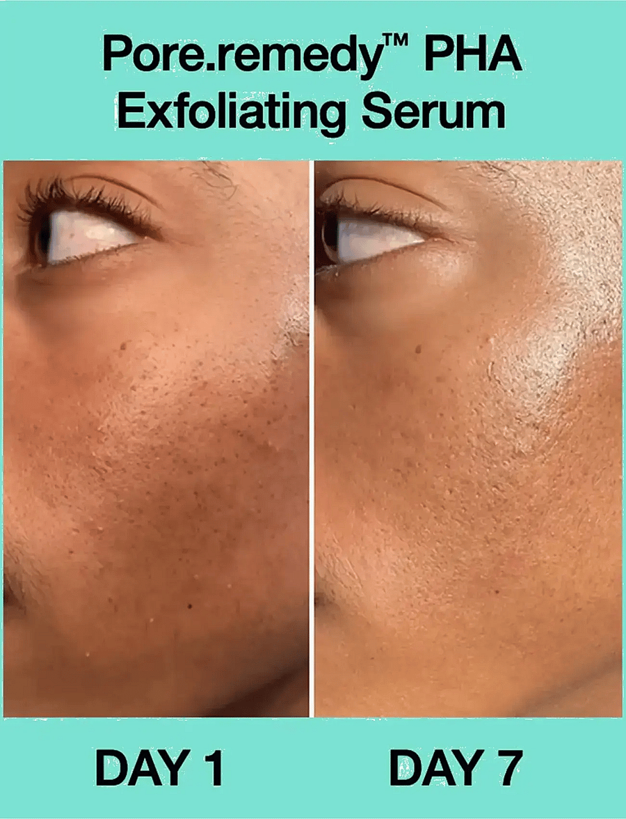 Dr.Jart+ - Pore·remedy PHA Exfoliating Serum - seerumit - clear - 2