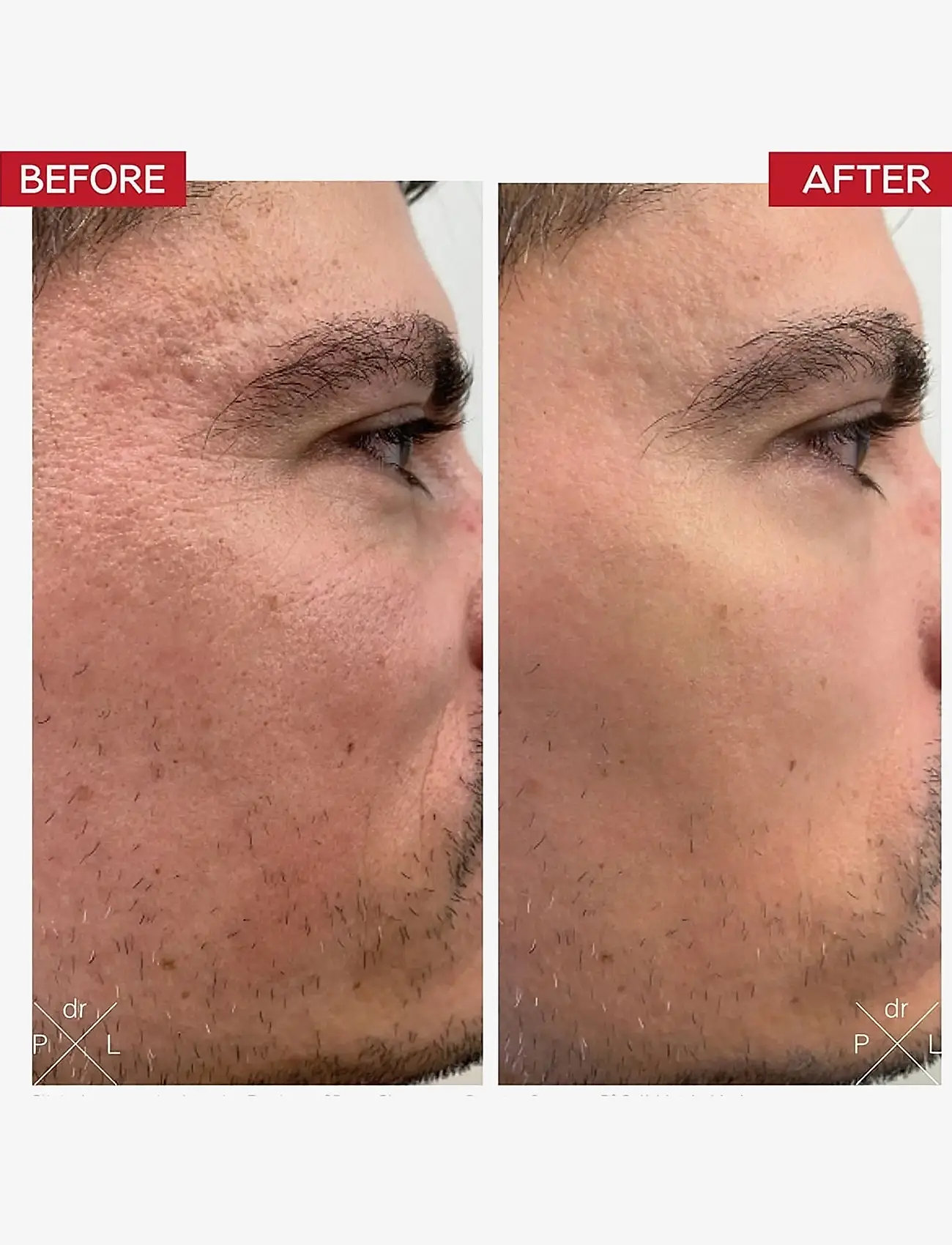 Dr. Levy - Booster Serum - serum - white - 2