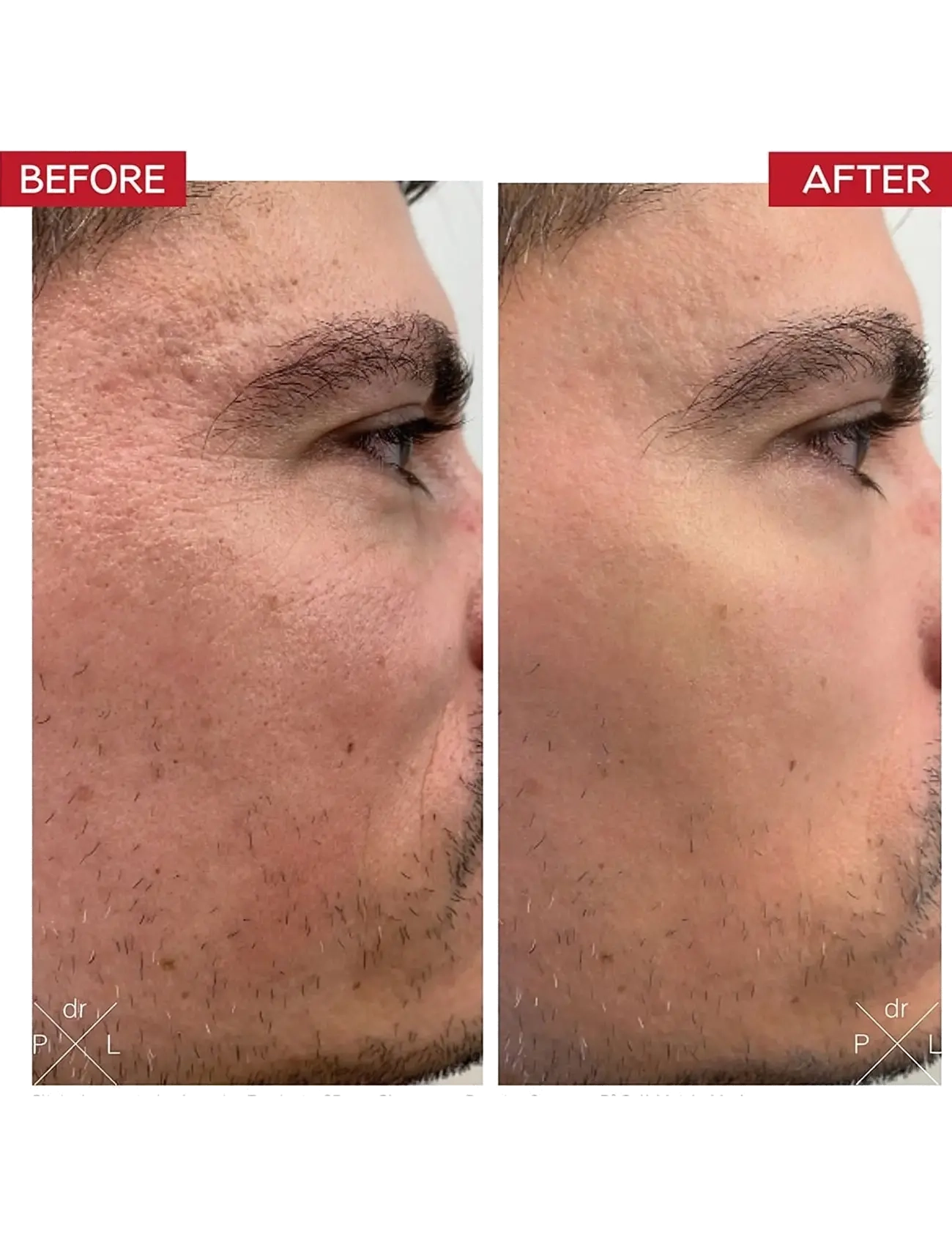Dr. Levy - Booster Serum - serums - white - 2