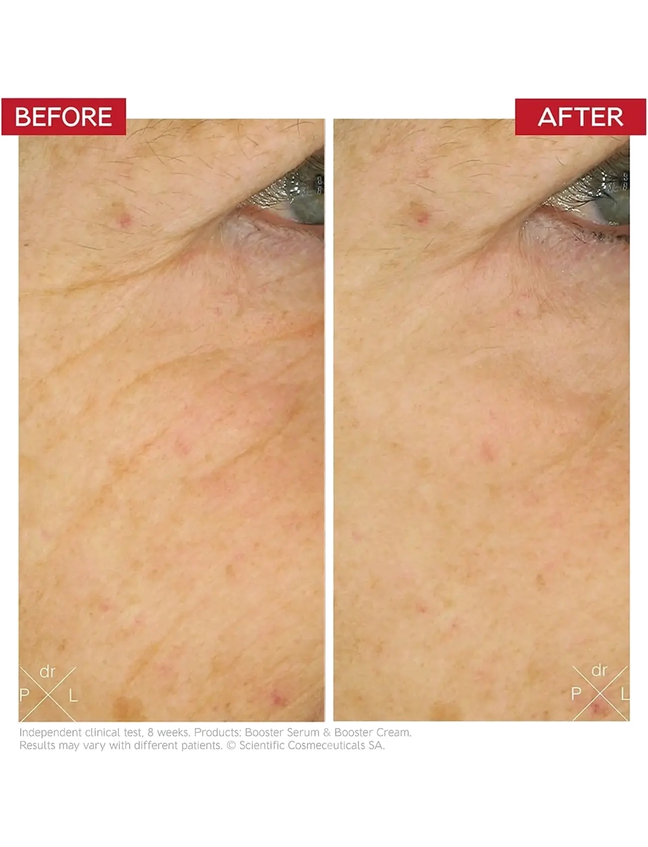 Dr. Levy - Booster Cream - rakagjafar - white - 2