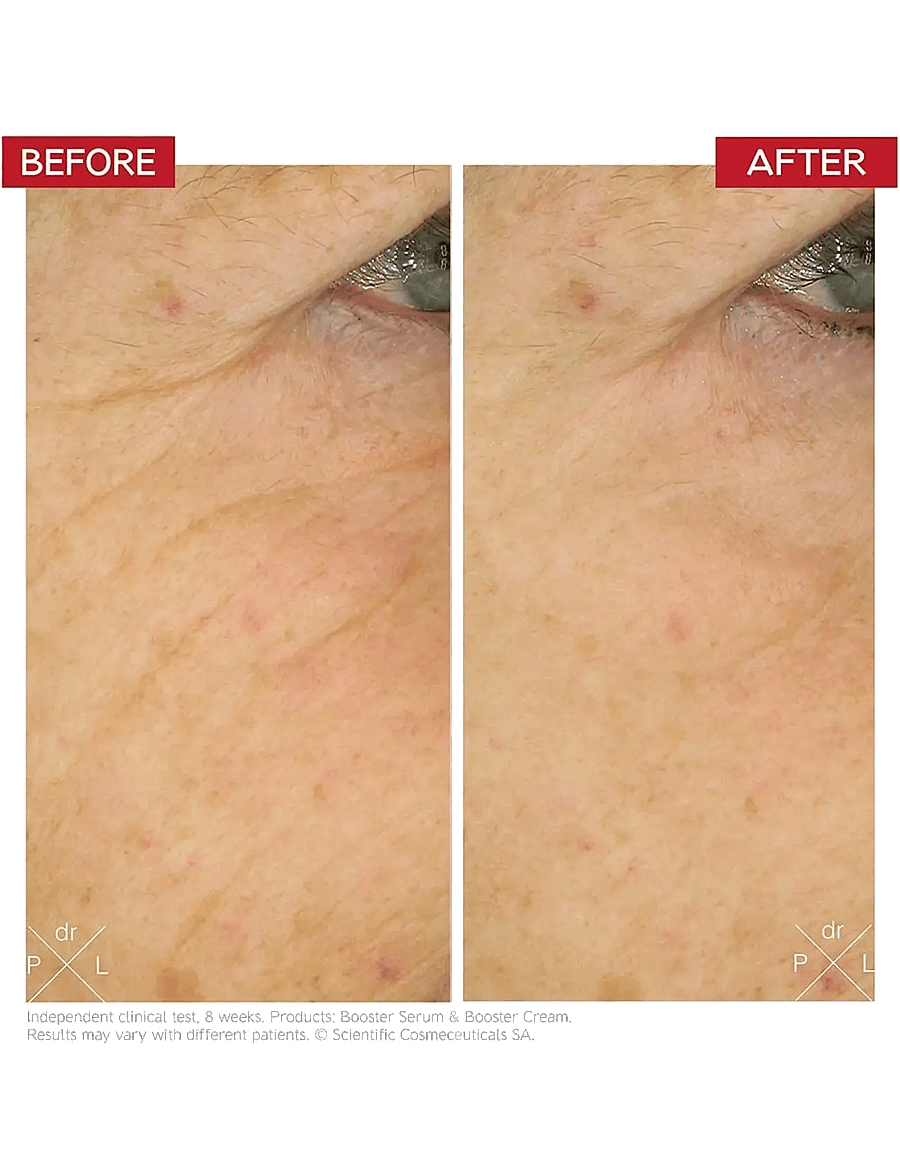 Dr. Levy - Booster Cream - fugtpleje - white - 2