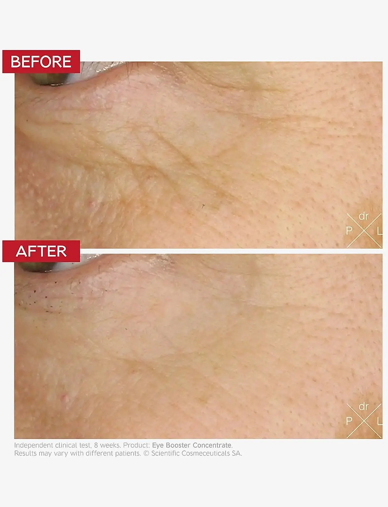 Dr. Levy - Eye Booster Concentrate - Ögonkräm - white - 2