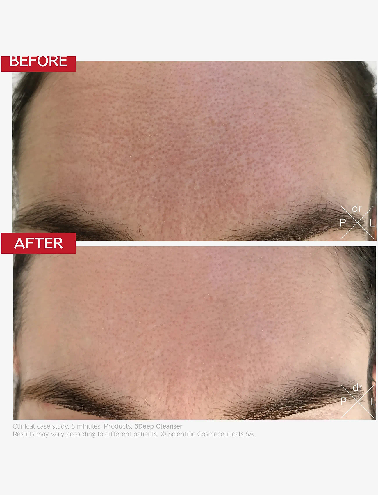 Dr. Levy - 3Deep Cell Renewal Micro-Resurfacing Cleanser - peeling - ansigte - white - 2