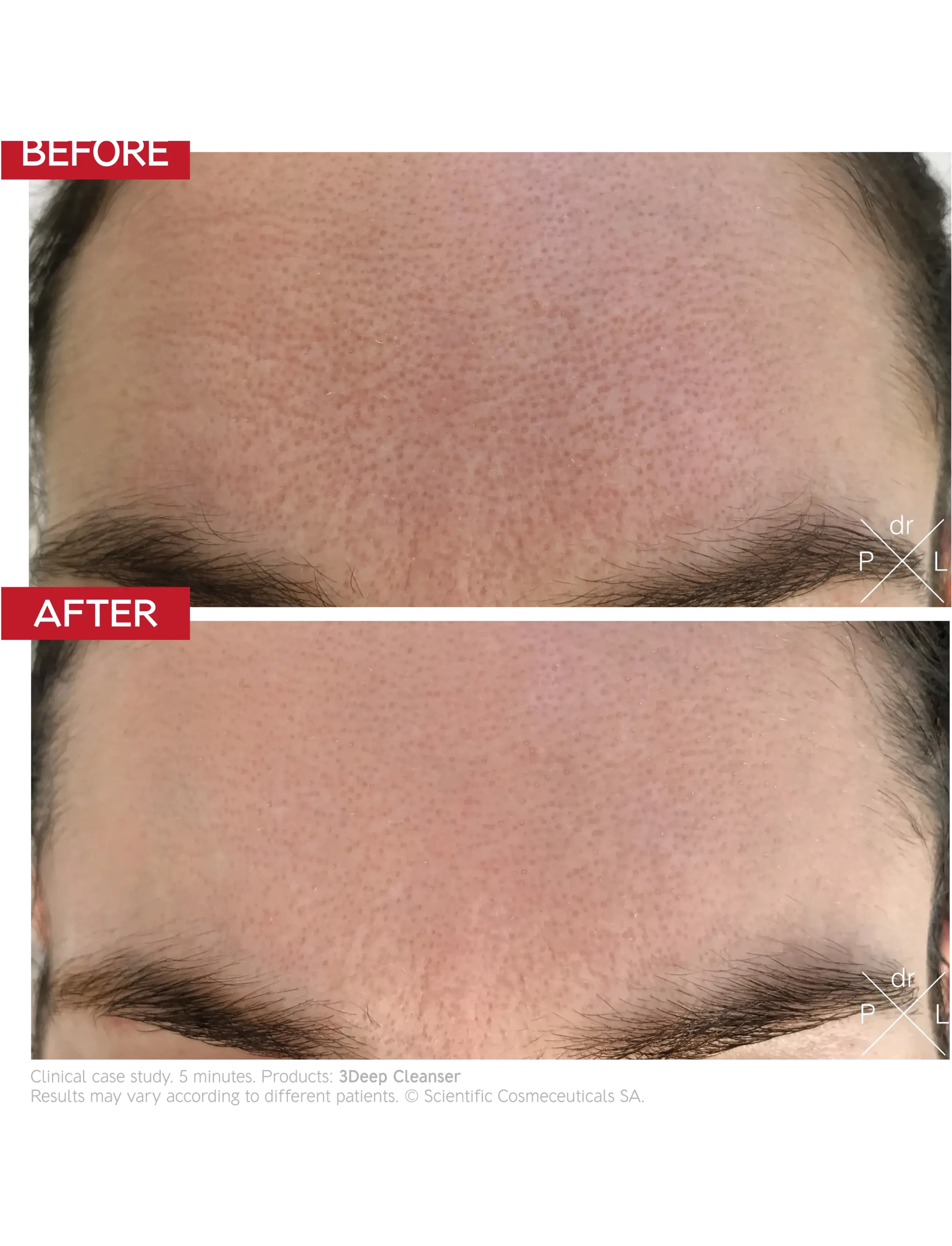 Dr. Levy - 3Deep Cell Renewal Micro-Resurfacing Cleanser - peeling - white - 2