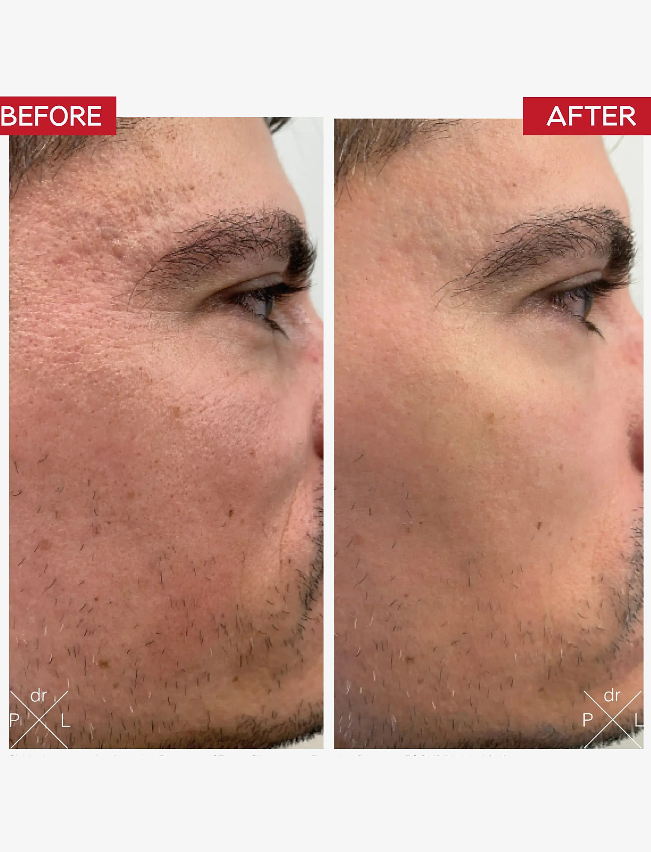 Dr. Levy - MicroSkin Roller - tilbehør til hudpleje - black - 3