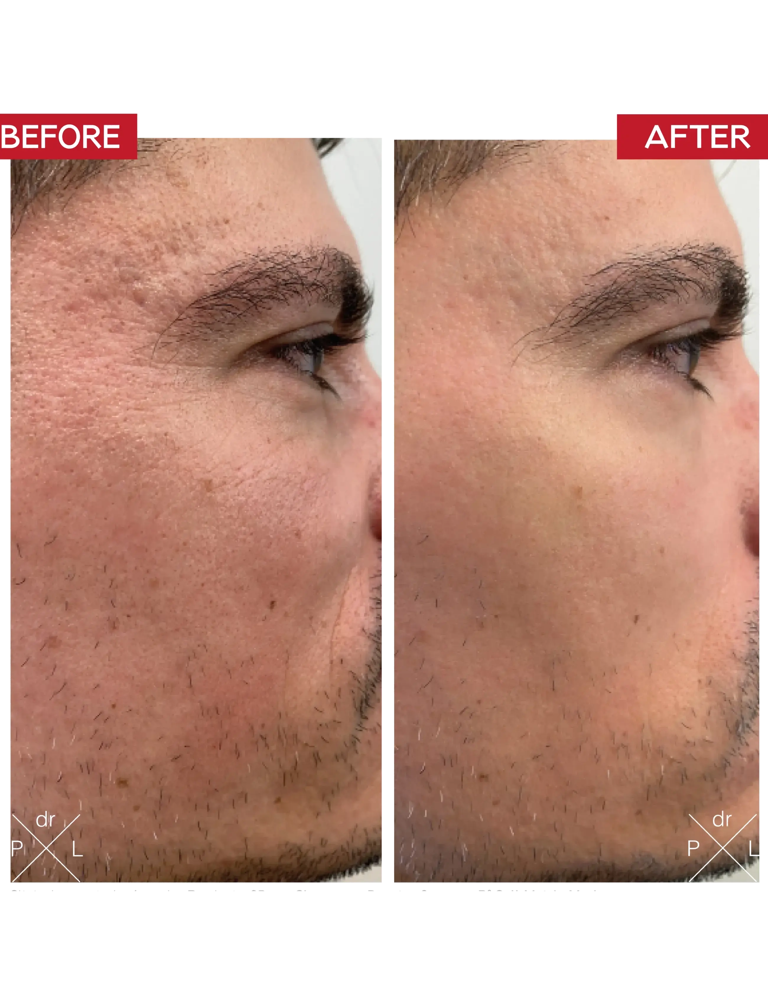 Dr. Levy - MicroSkin Roller - tilbehør til hudpleje - black - 3