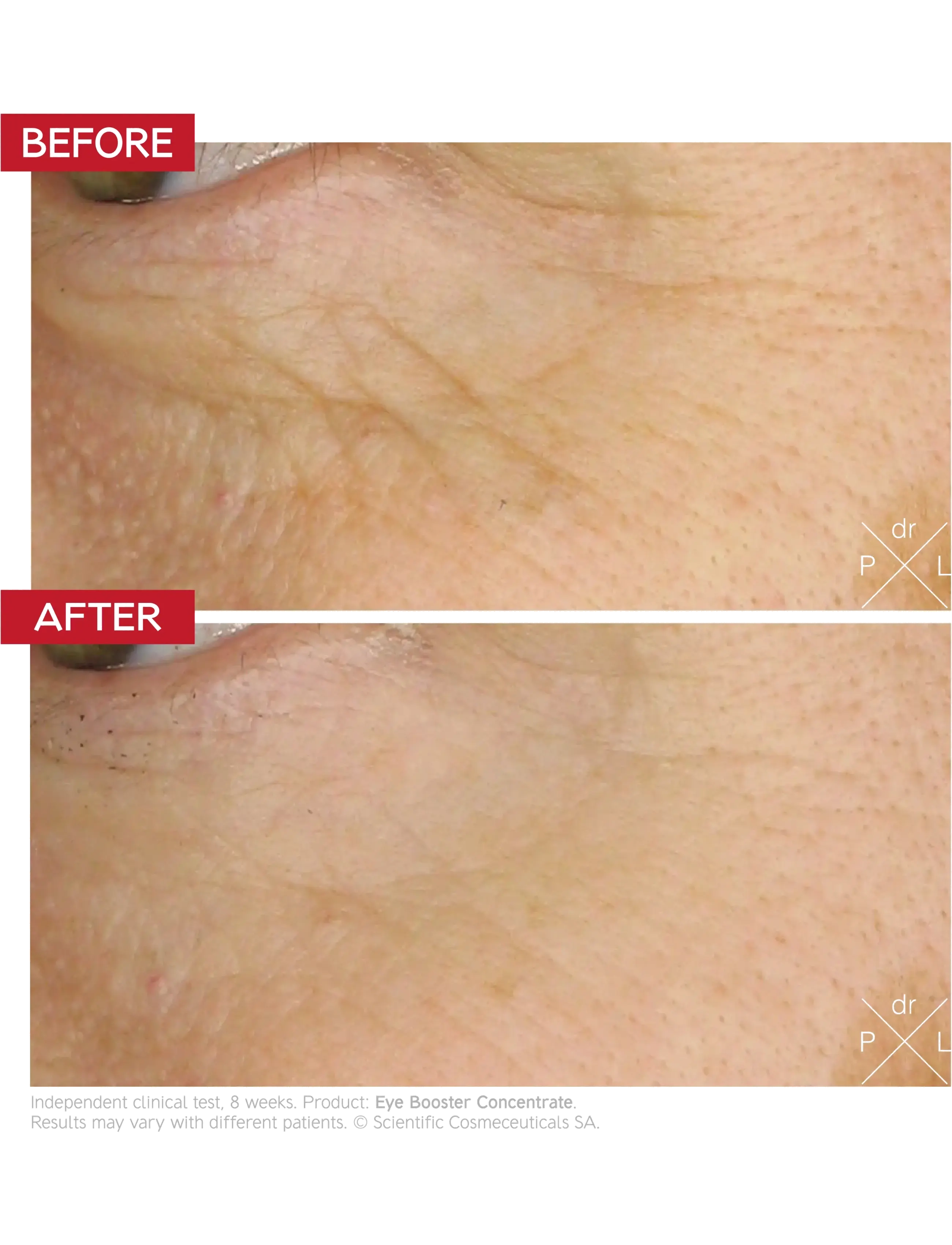 Dr. Levy - The Eye Longevity Ritual - clear - 3