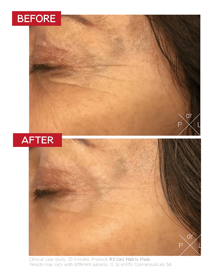 Dr. Levy - The Face Longevity Ritual - naisille - clear - 4