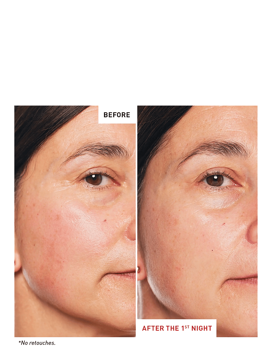 Erborian - Skin Therapy - seerumid - no color - 3