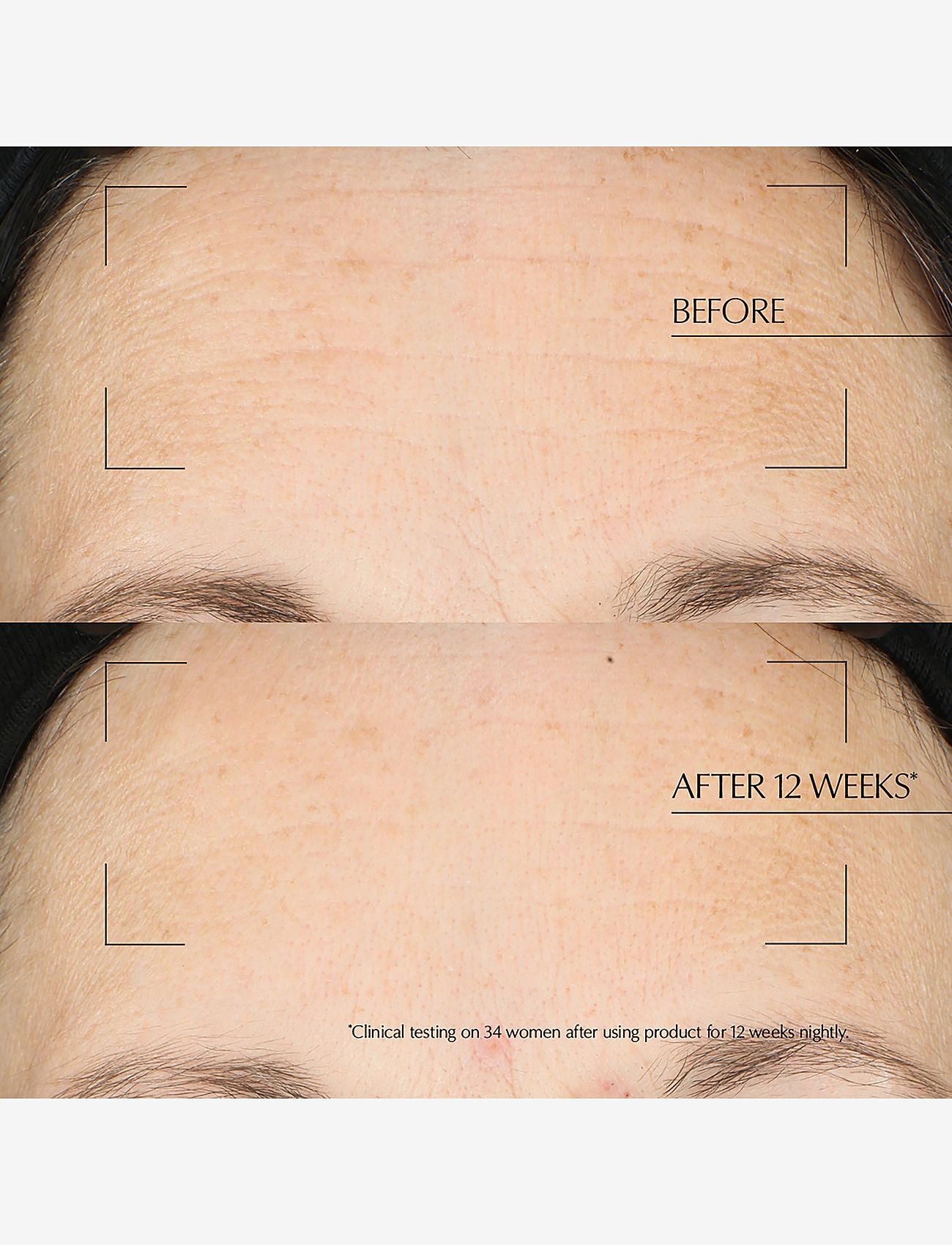 Estée Lauder - Advanced Night Repair Overnight Treatment Mask - sommerens hudpleje - multi - 4