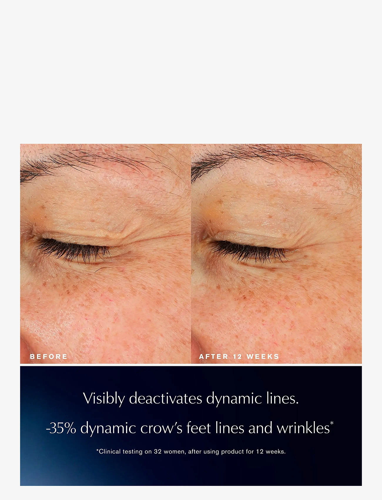 Estée Lauder - Advanced Night Repair Eye Lift + Sculpt Serum - Øjencremer - clear - 2