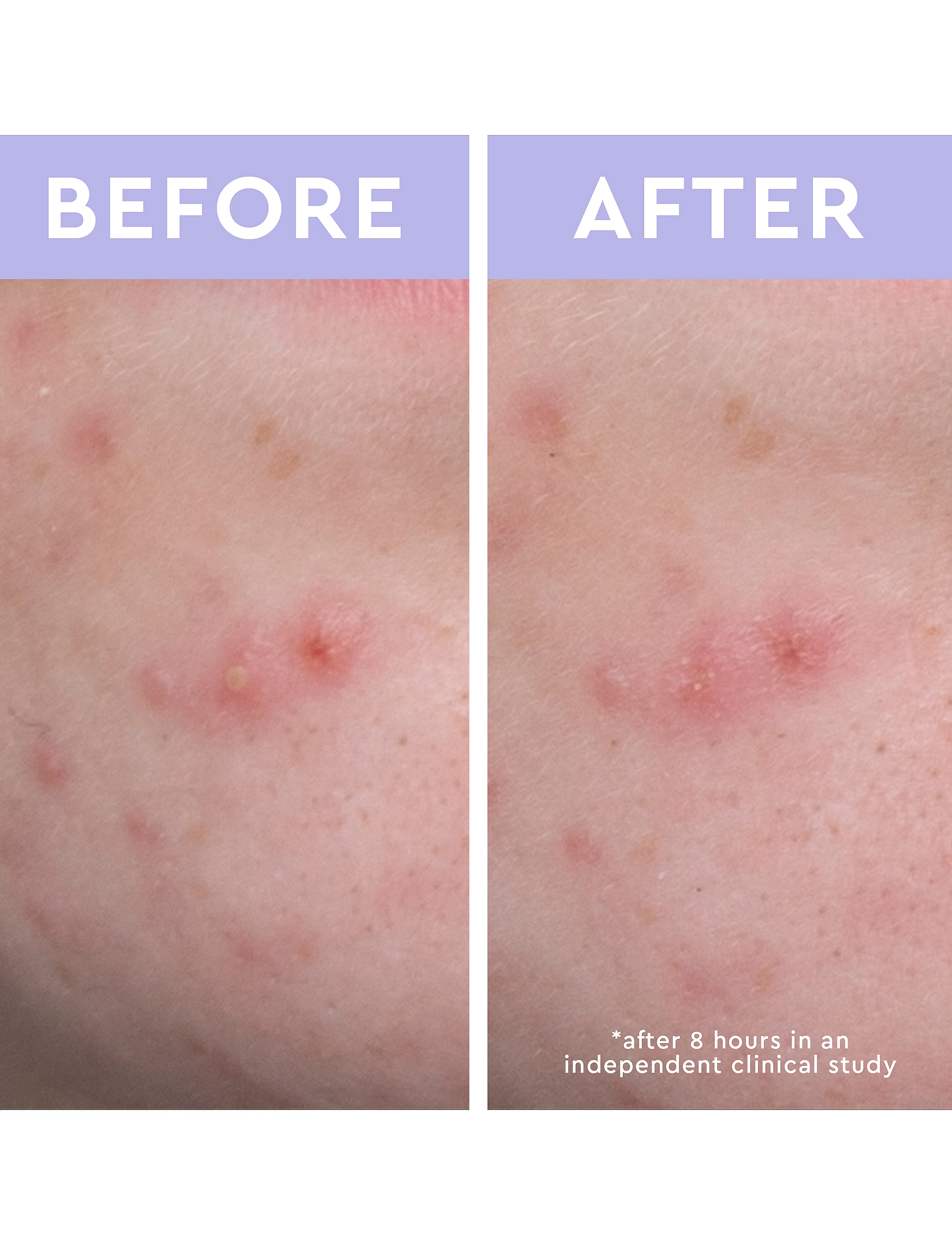 Florence By Mills - Spot a Spot Blemish Patches - clear - 3