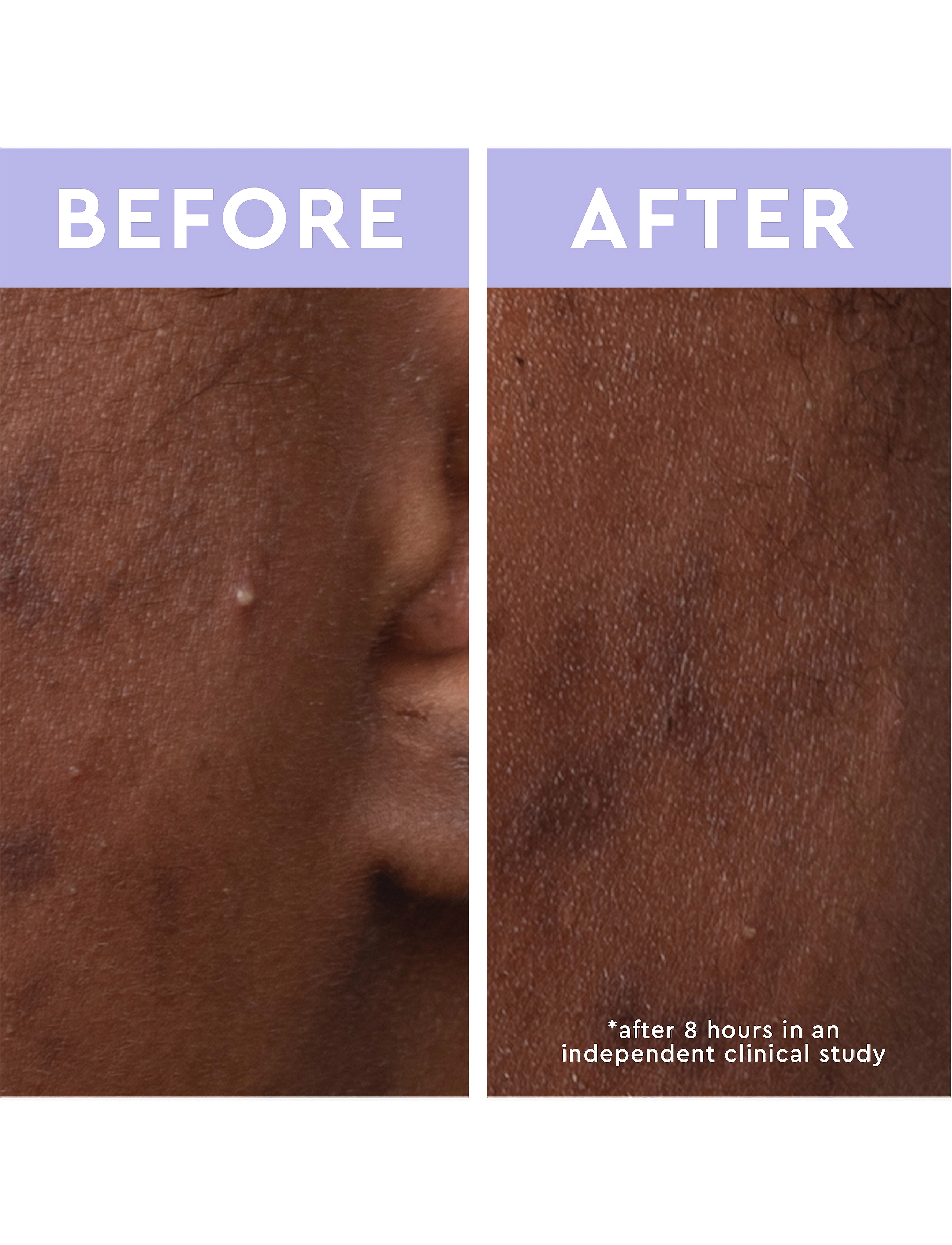 Florence By Mills - Spot a Spot Blemish Patches - clear - 4