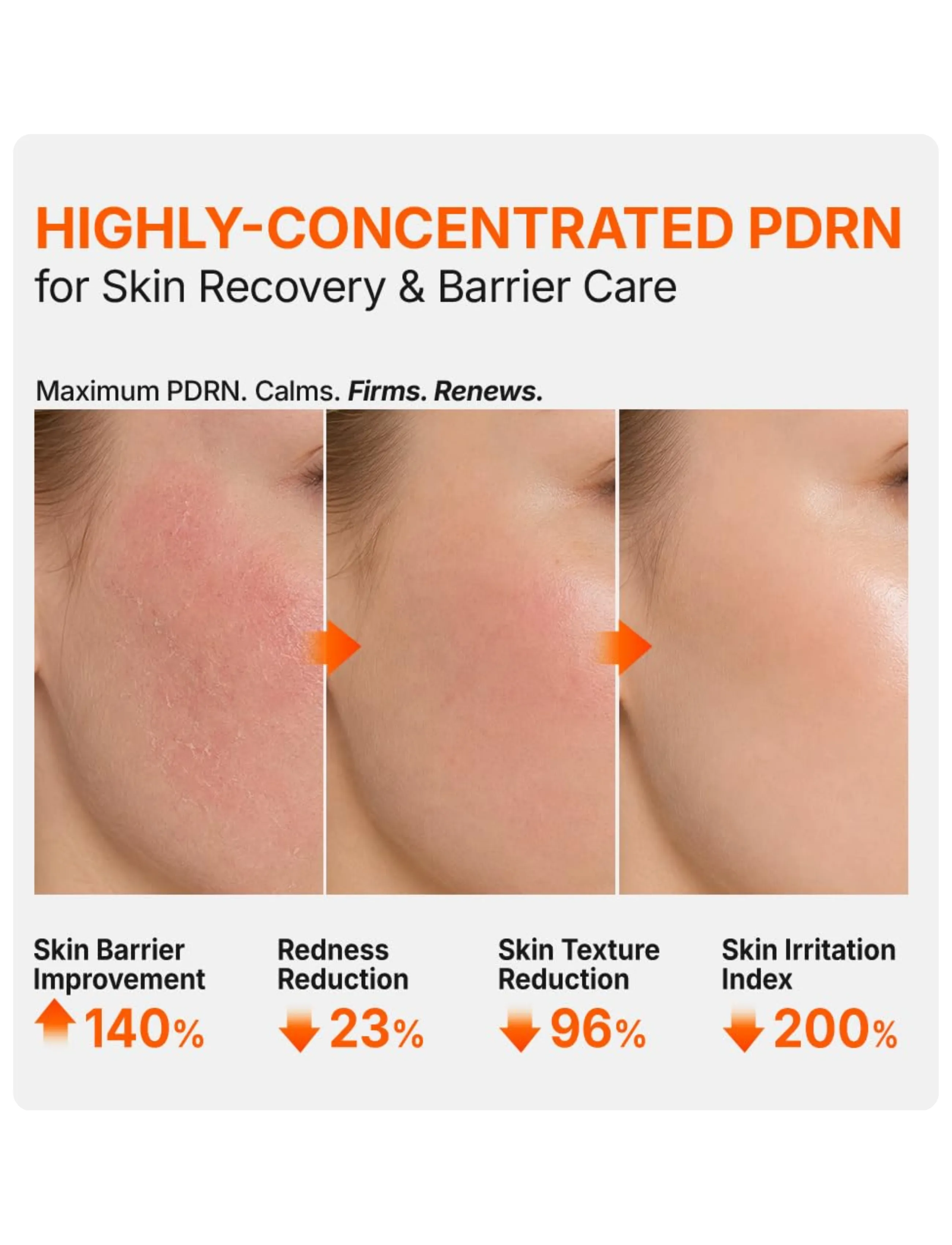 Genabelle - PDRN 3% Hyper Boost Ampoule - serum - clear - 3