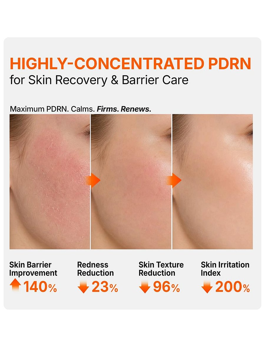 Genabelle - PDRN 3% Hyper Boost Ampoule - seerumid - clear - 3