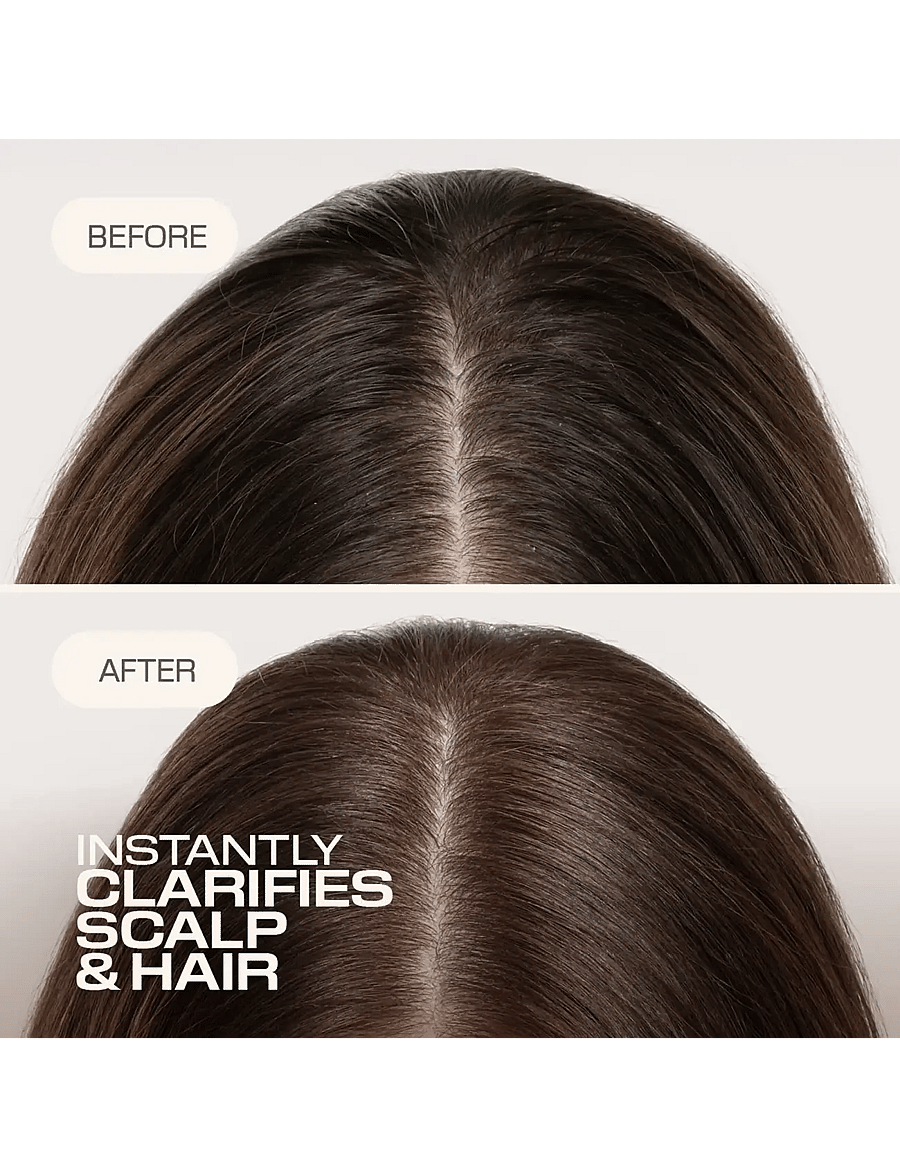 Goldwell - Goldwell Dualsenses Scalp Specialist Clarifying Shampoo 250ml - Šampoon - clear - 2