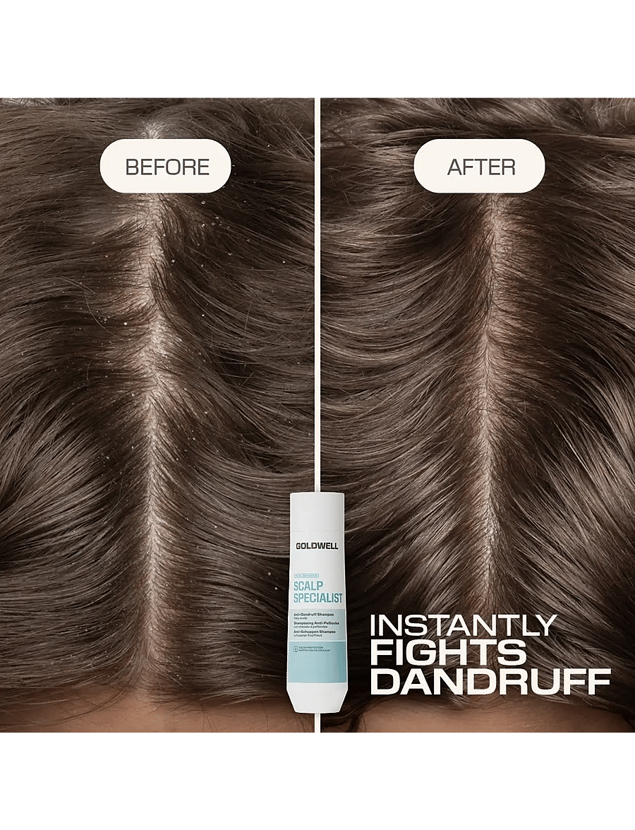 Goldwell - Goldwell Dualsenses Scalp Specialist Anti-Dandruff Shampoo 250ml - Šampoon - clear - 2