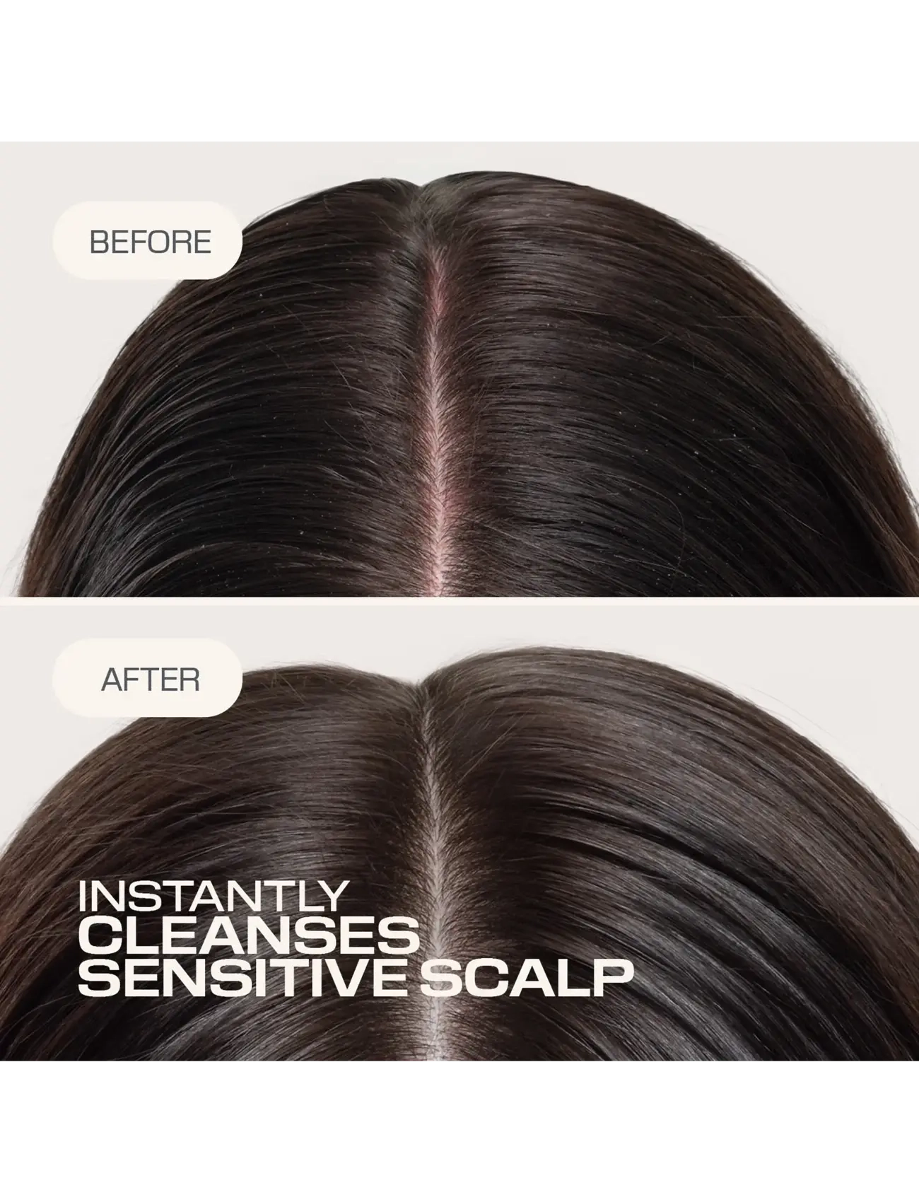 Goldwell - Goldwell Dualsenses Scalp Specialist Sensitive Foam Shampoo 250ml - shampoo - clear - 2