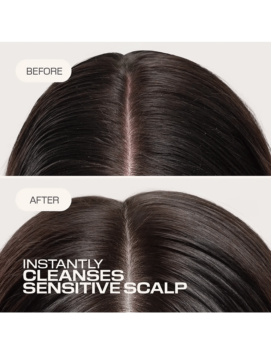 Goldwell - Goldwell Dualsenses Scalp Specialist Sensitive Foam Shampoo 250ml - Šampoon - clear - 2