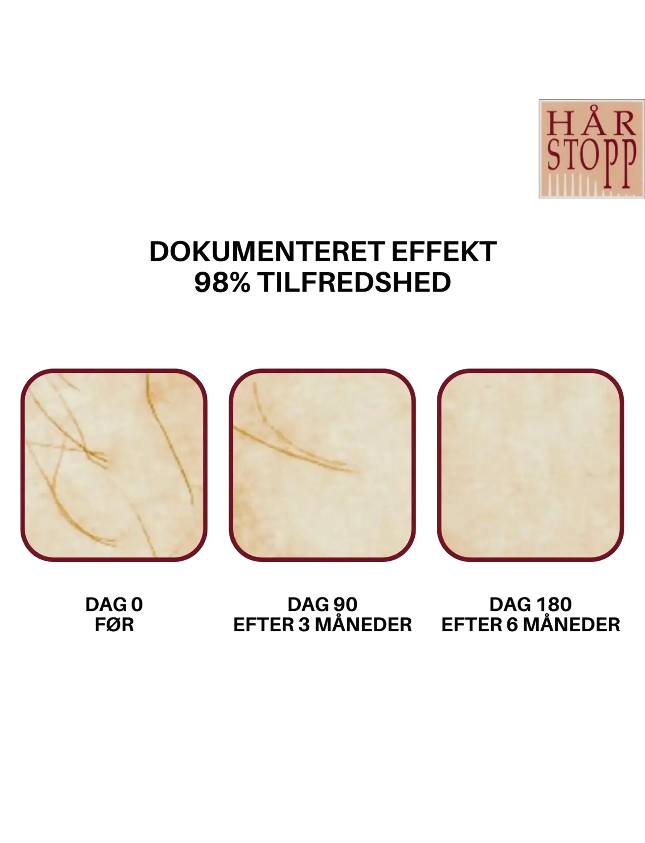HårStopp - HårStopp Body - barbering - white - 5
