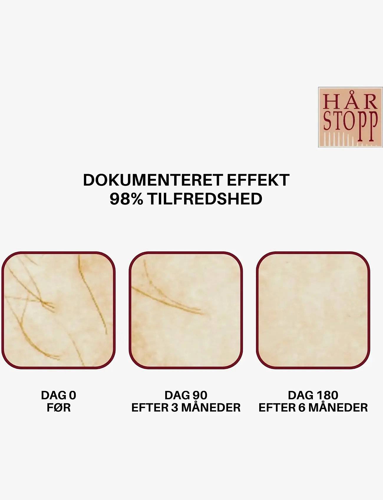 HårStopp - HårStopp Face - barbering - white - 5