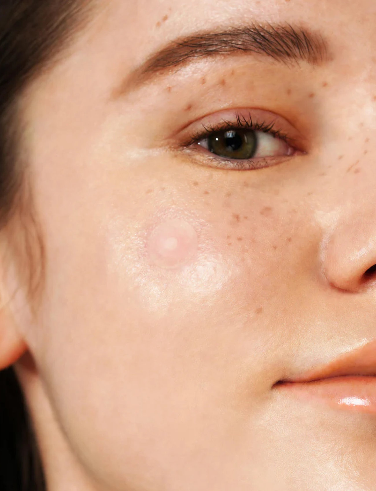 Isntree - Onion Newpair Spot Patch - de laveste prisene - clear - 3