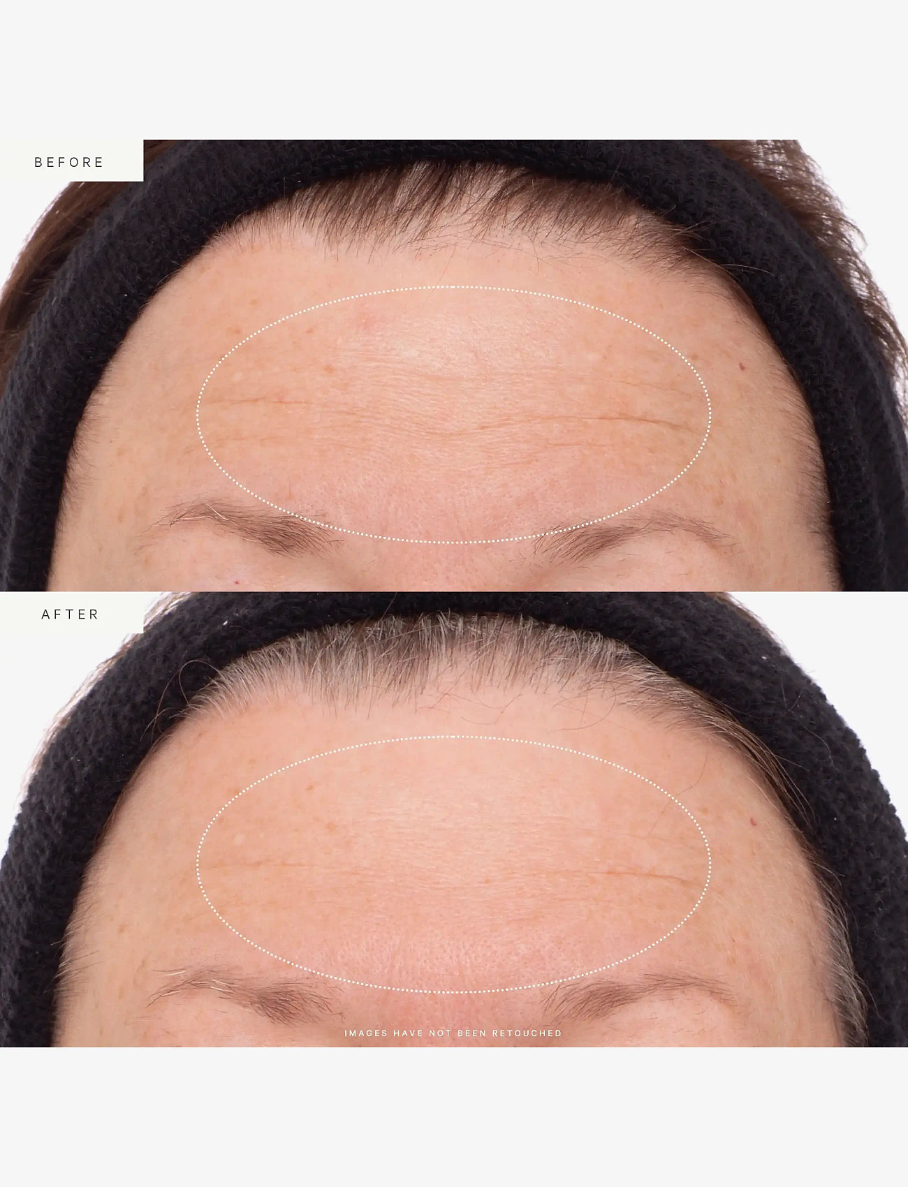 Kora Organics - Plant Stem Cell Retinol Alternative Serum 10ml - resestorlekar & kits - 10 ml - 4