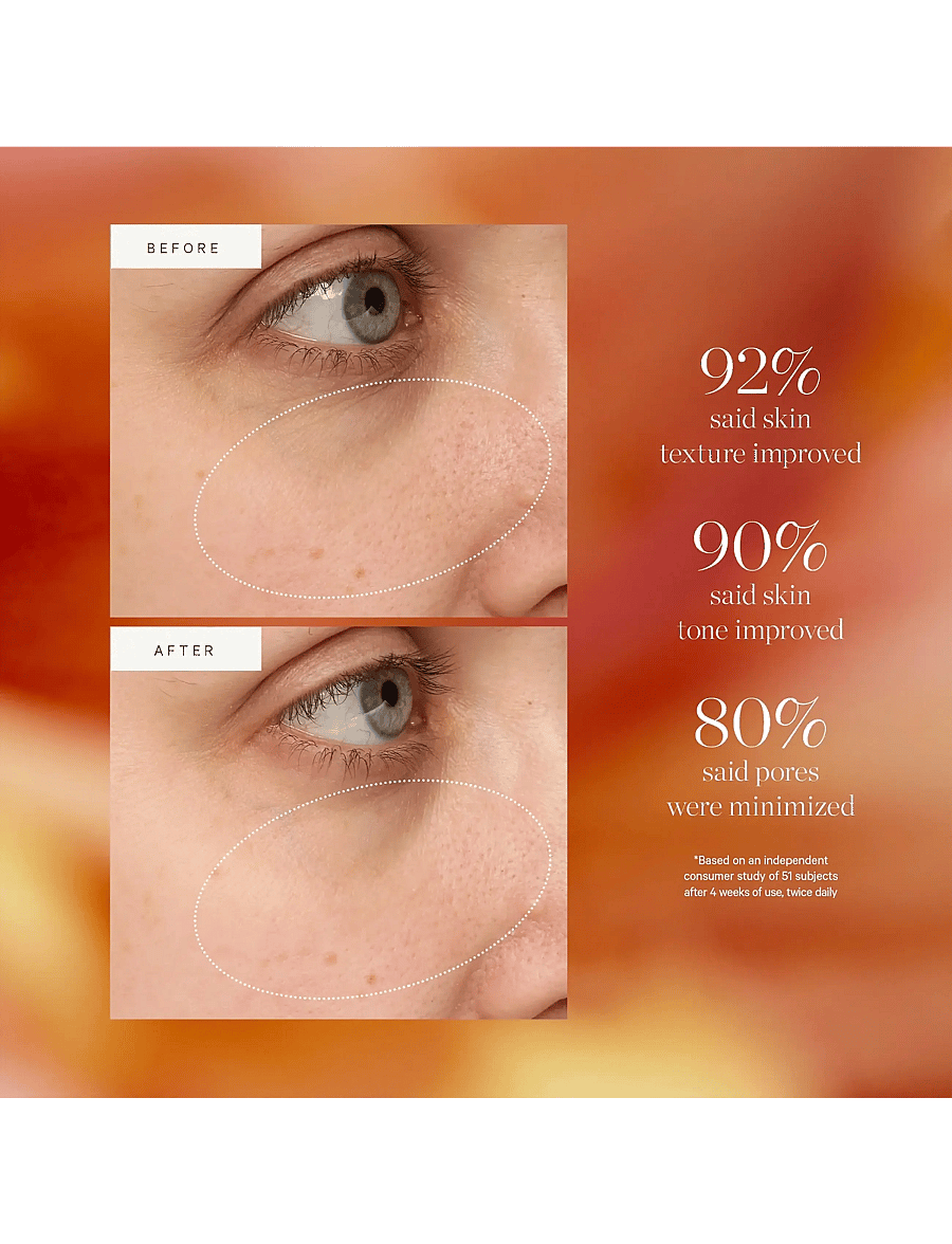Kora Organics - Turmeric Glow Drops Niacinamide Alternative Serum - seerumid - no colour - 3