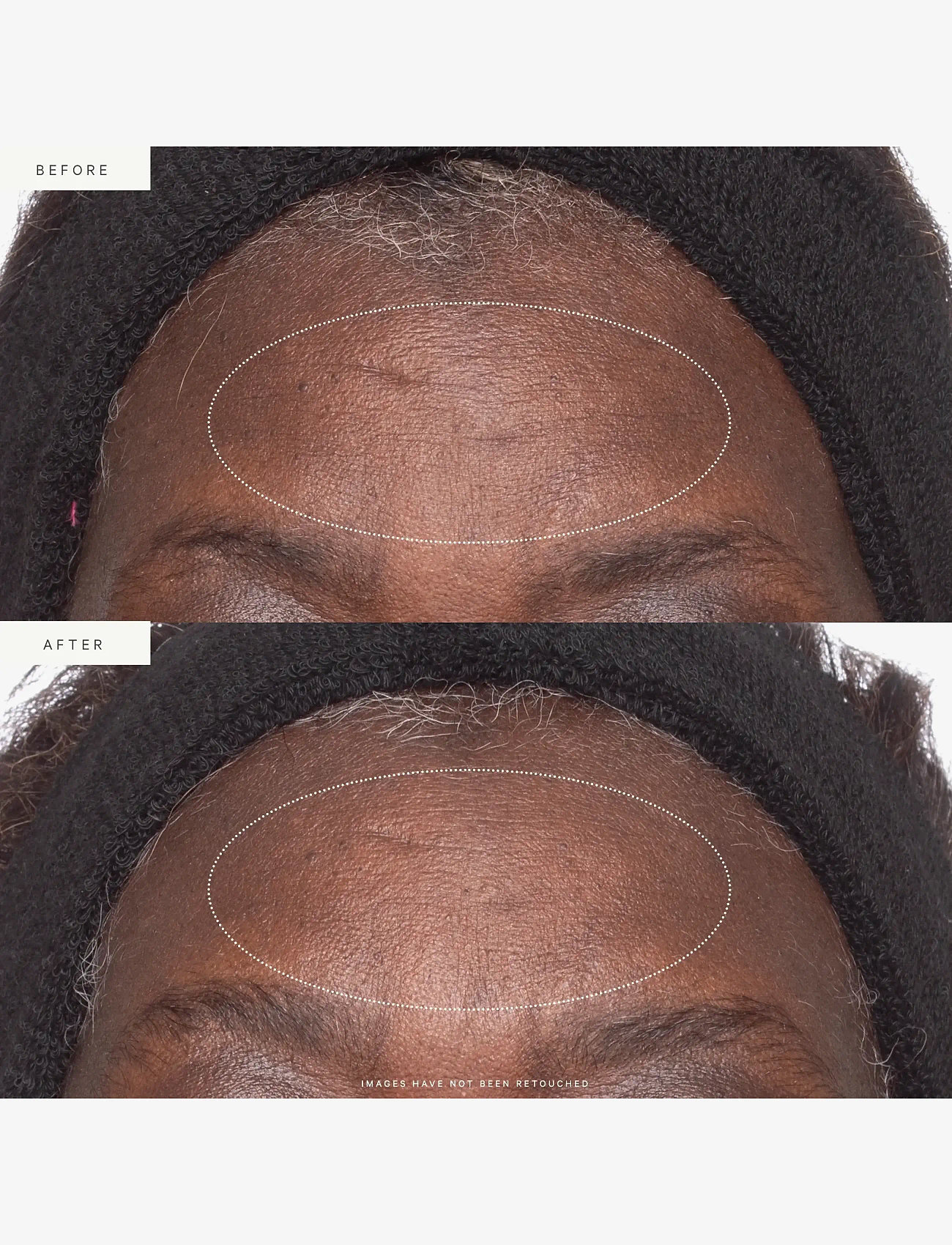 Kora Organics - Plant Stem Cell Retinol Alternative Moisturizer 50ml - dagkräm - na - 5