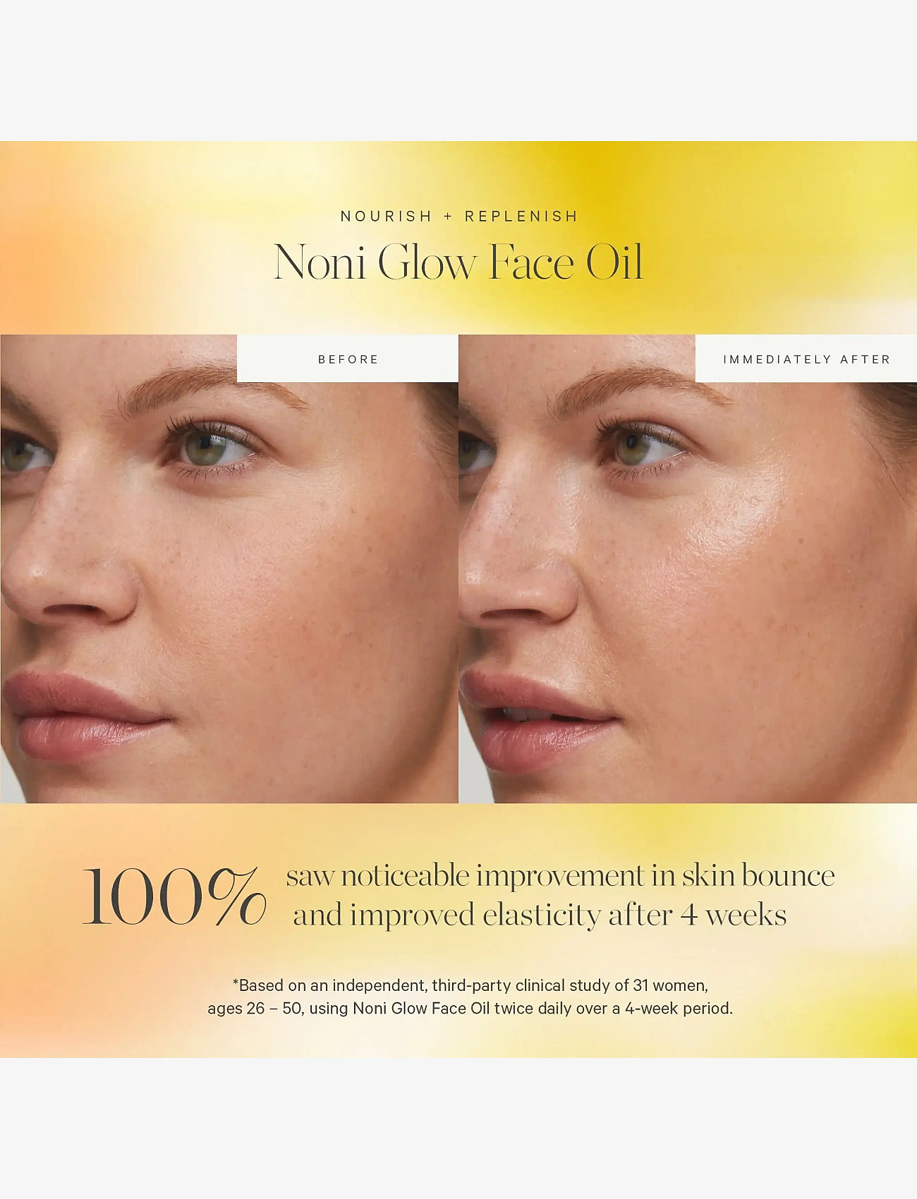 Kora Organics - Noni Glow Face Oil 30ml - rejsestørrelser & kits  - clear/transparant - 3