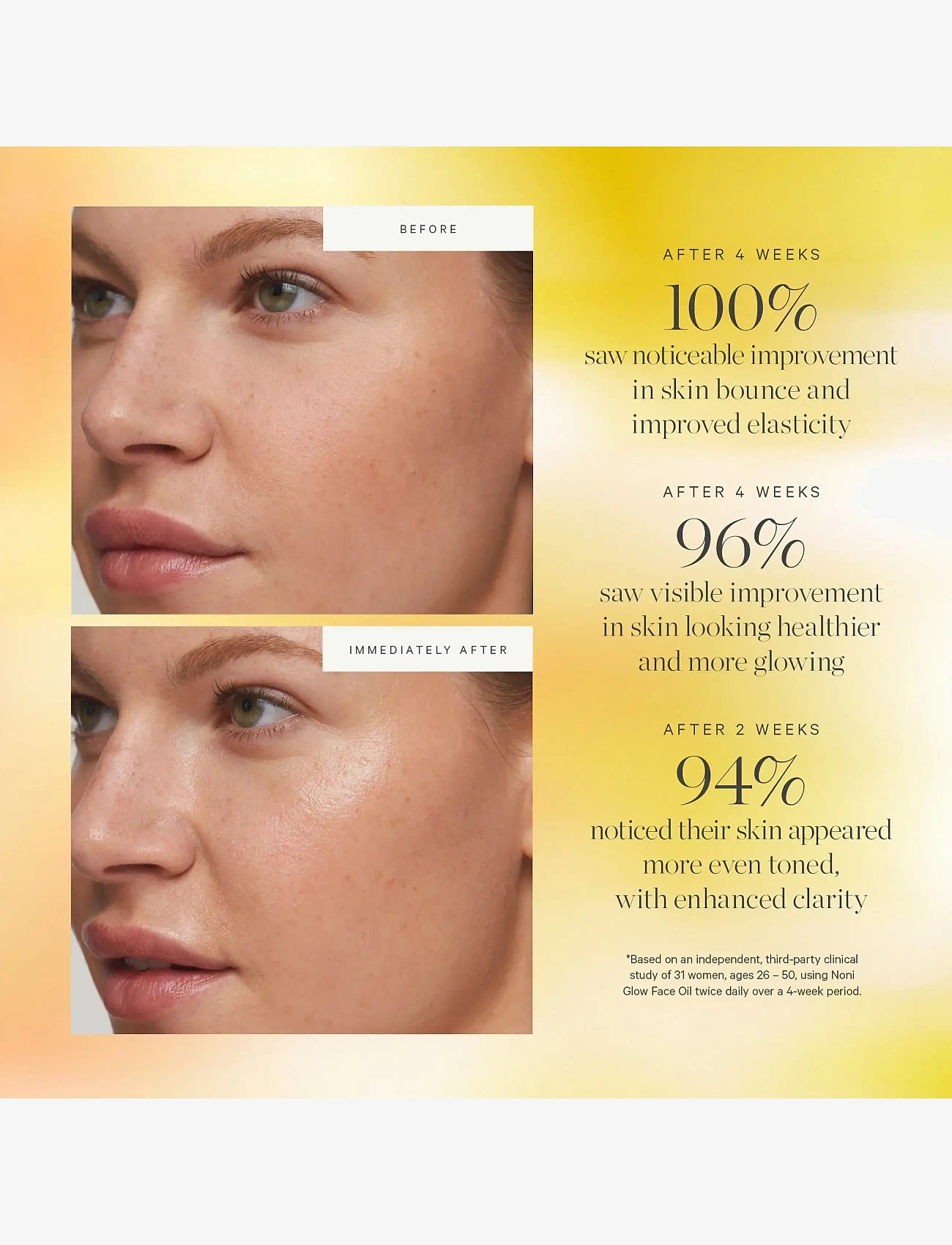 Kora Organics - Noni Glow Face Oil 30ml - rejsestørrelser & kits  - clear/transparant - 4