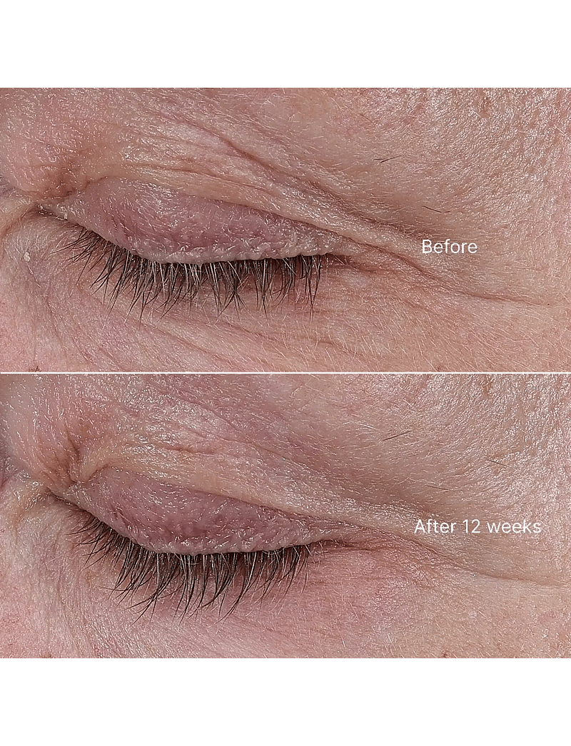 La Mer - The Rejuvenating Eye Cream 15ml - Øjencremer - clear - 5