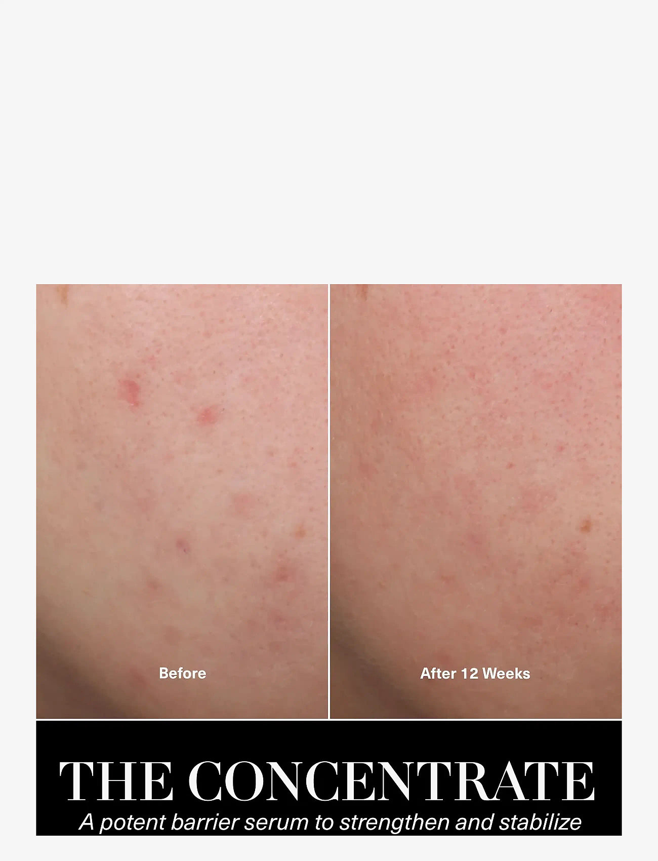 La Mer - The Concentrate - serum & oljor  - clear - 4