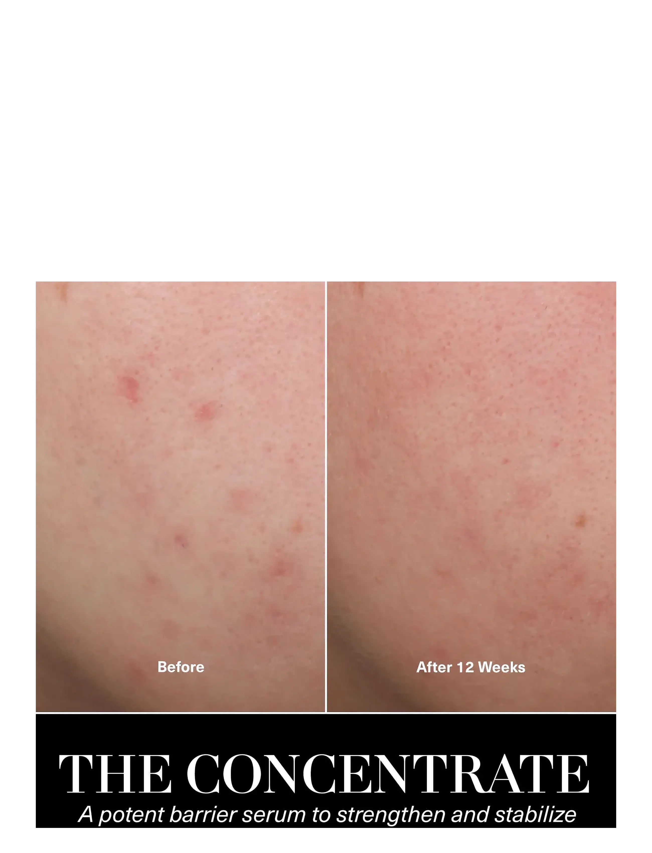 La Mer - The Concentrate - serum & oljor  - clear - 4