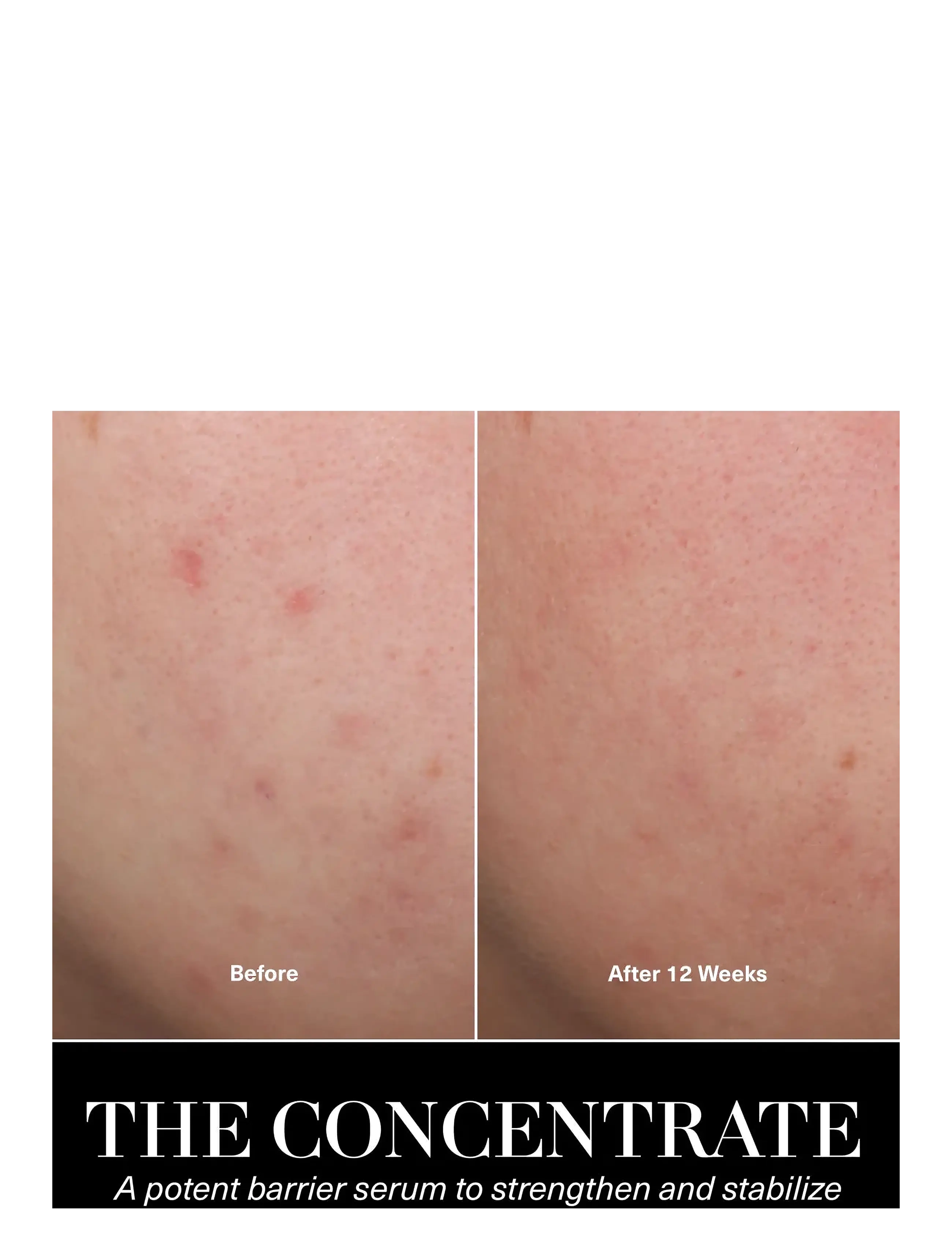 La Mer - The Concentrate - serum og olíur - clear - 4