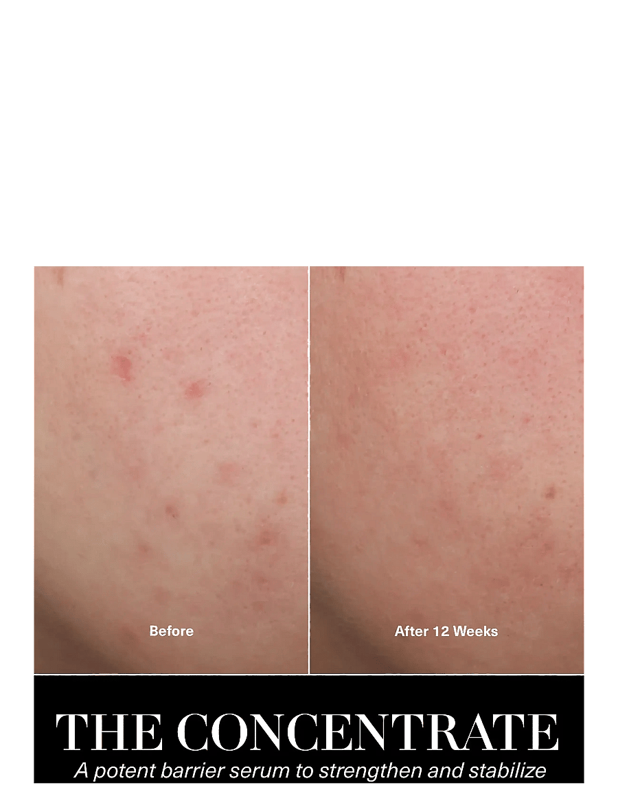 La Mer - The Concentrate - serum og olíur - clear - 4