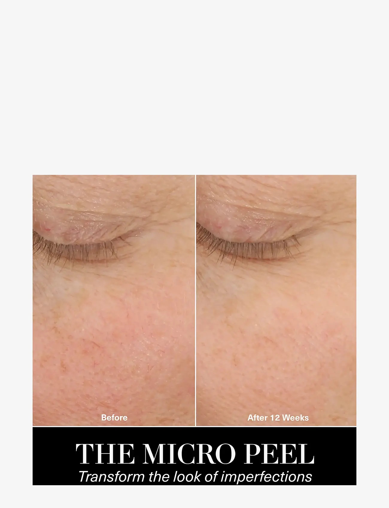 La Mer - The Micro Peel - ansiktspeeling - no colour - 3